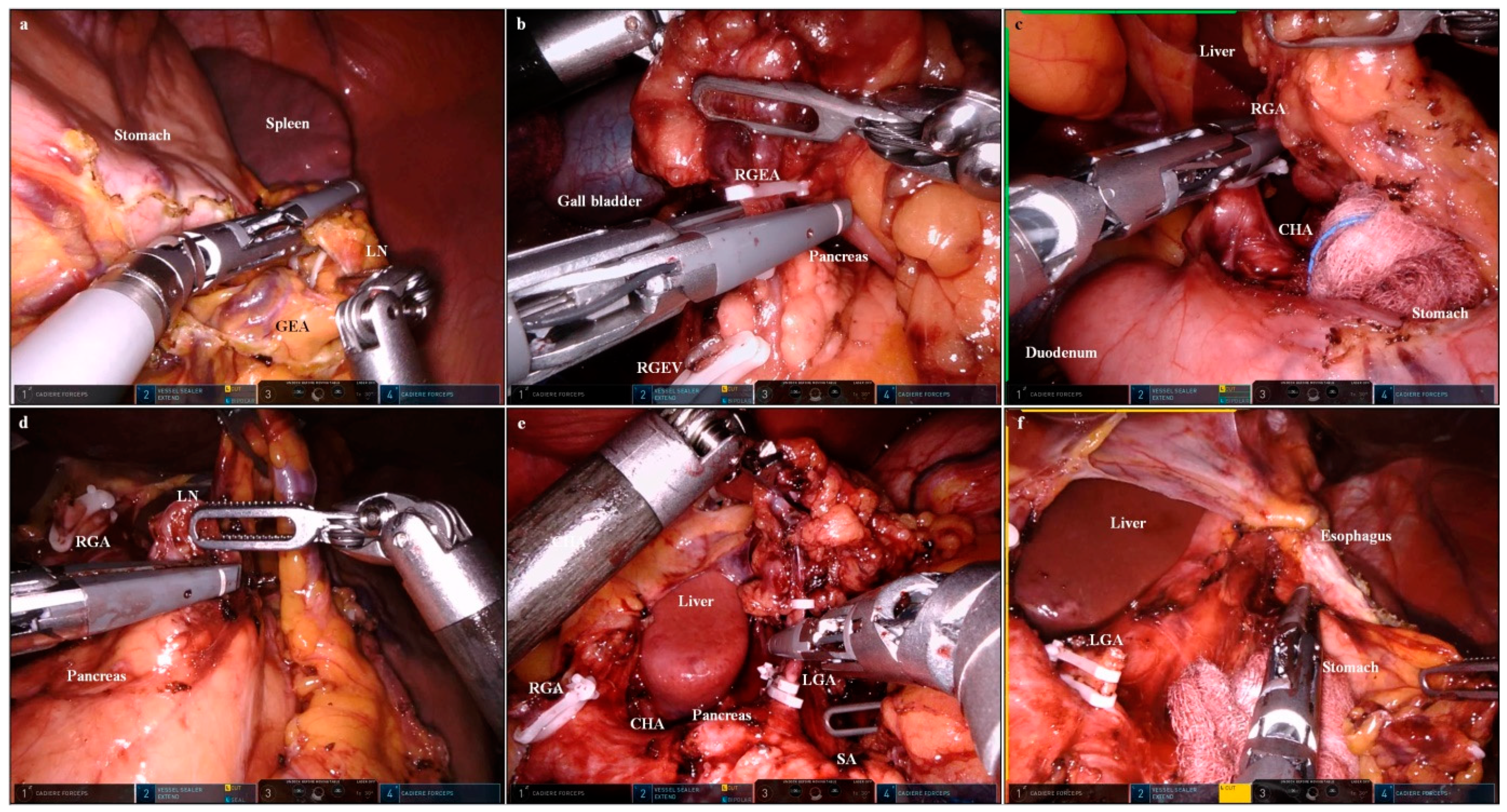 Cancers 15 05371 g002 Cancers 15 05371 g002