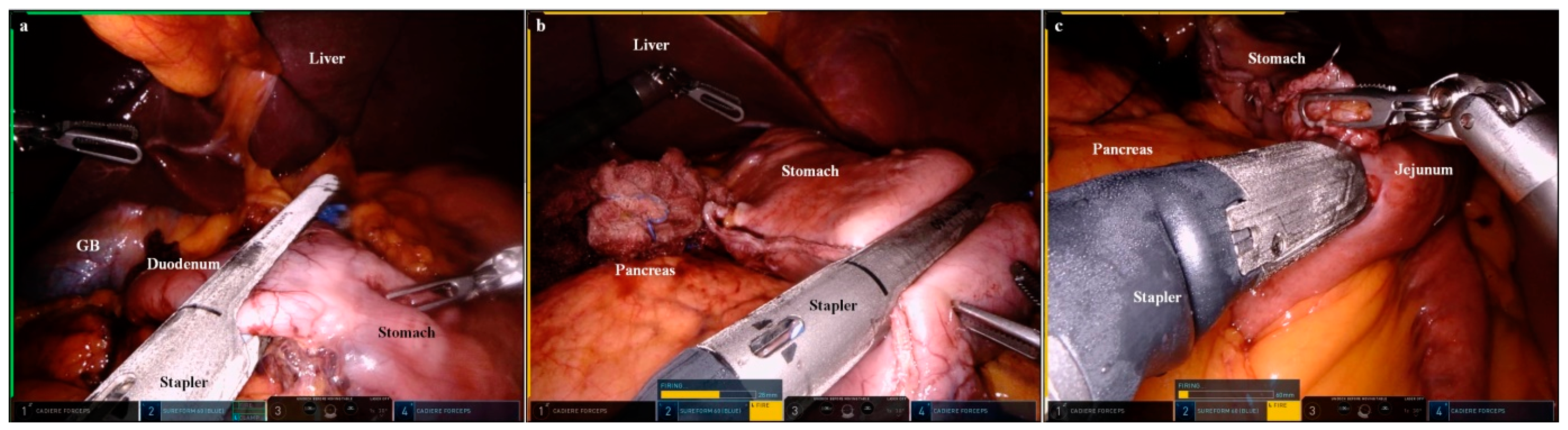 Cancers 15 05371 g003 Cancers 15 05371 g003