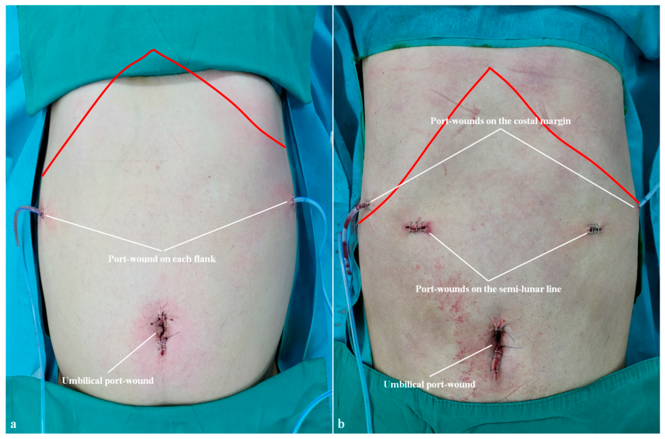 Cancers 15 05371 g004 Cancers 15 05371 g004