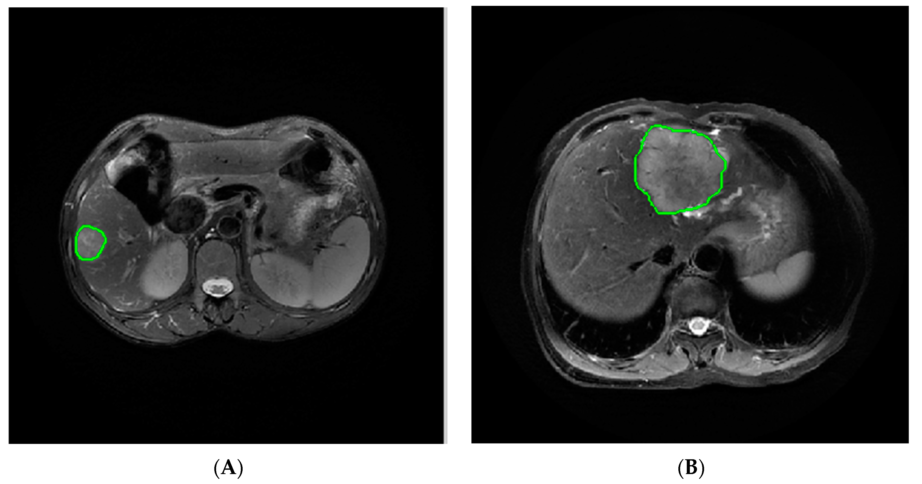 Cancers 15 05373 g002