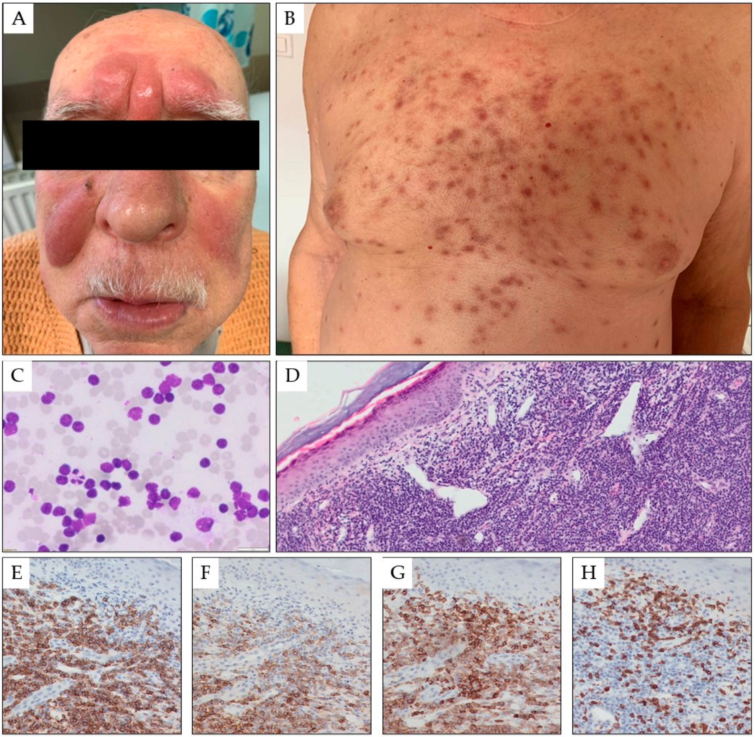 Cancers 15 05393 g001