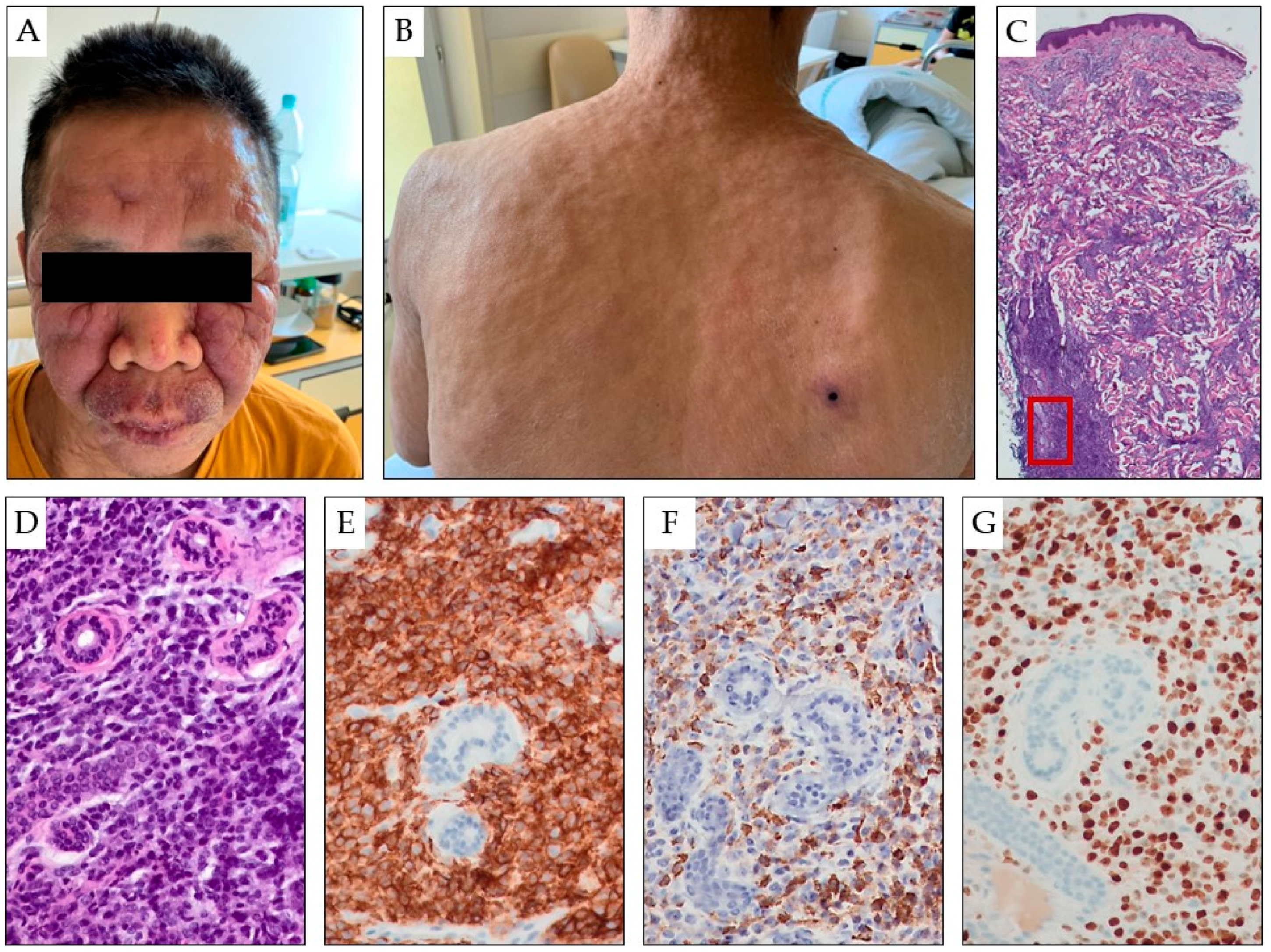 Cancers 15 05393 g004