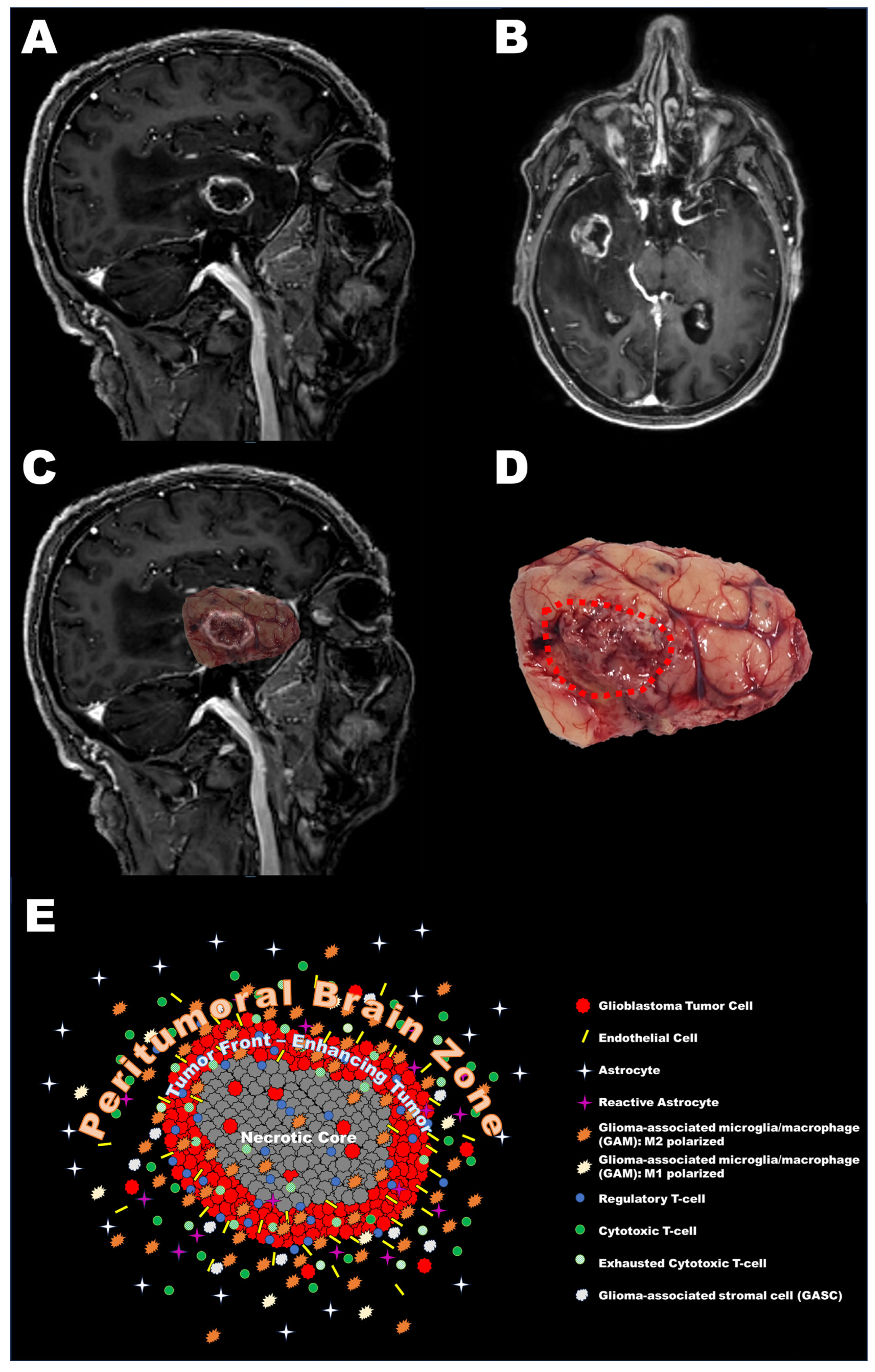 Cancers 15 05460 g002