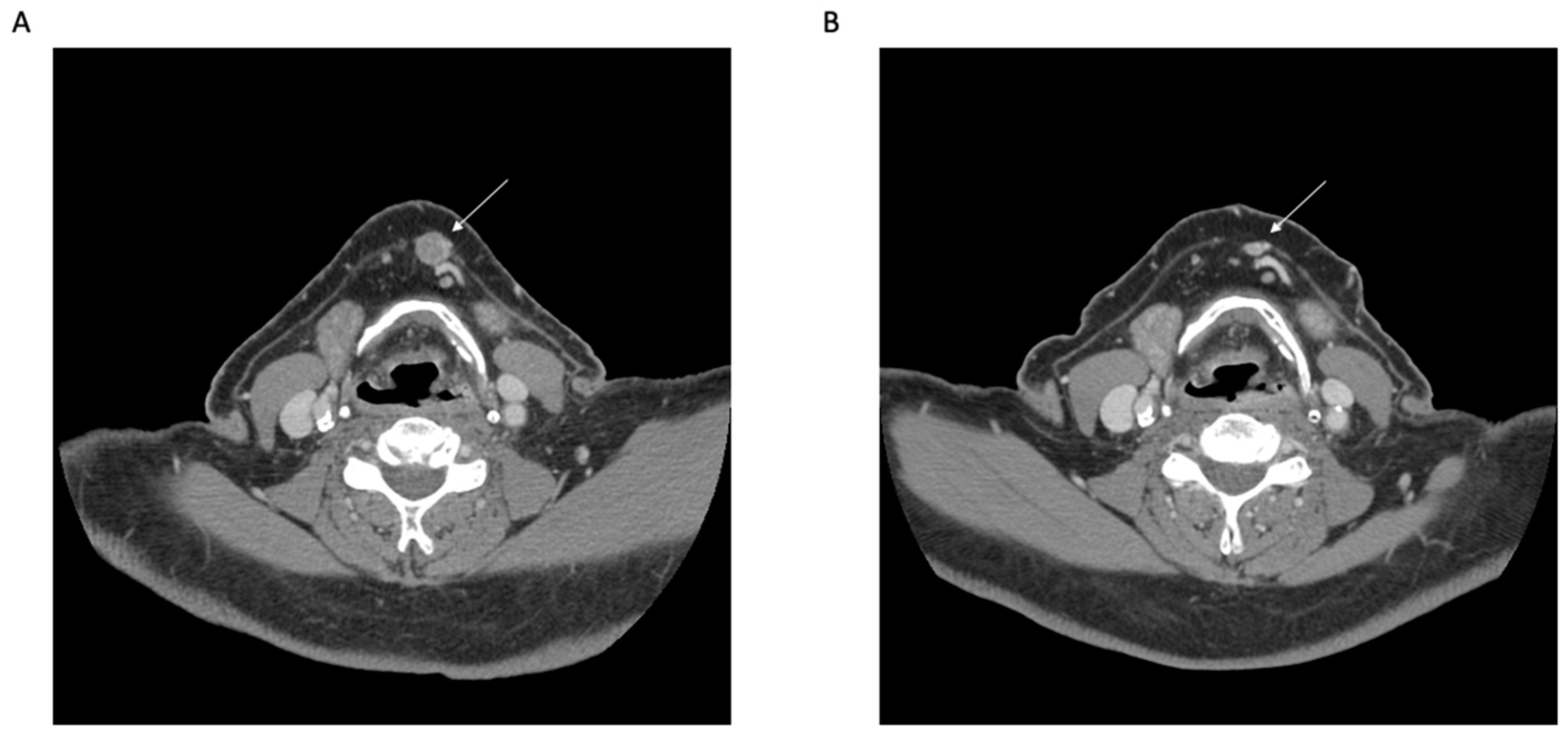 Cancers 15 05494 g002