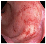 Cancers 15 05535 i006