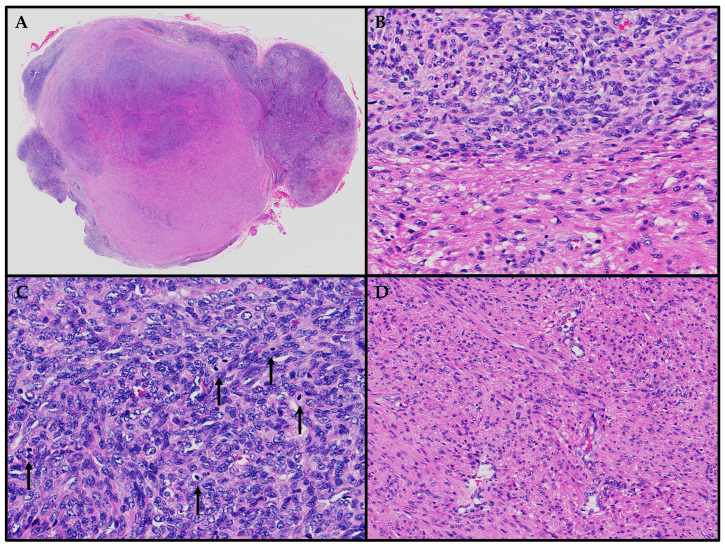 Cancers 15 05563 g002 Cancers 15 05563 g002