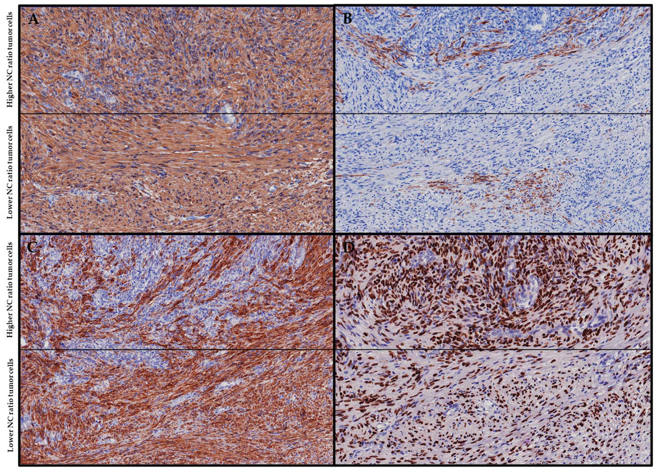 Cancers 15 05563 g003 Cancers 15 05563 g003