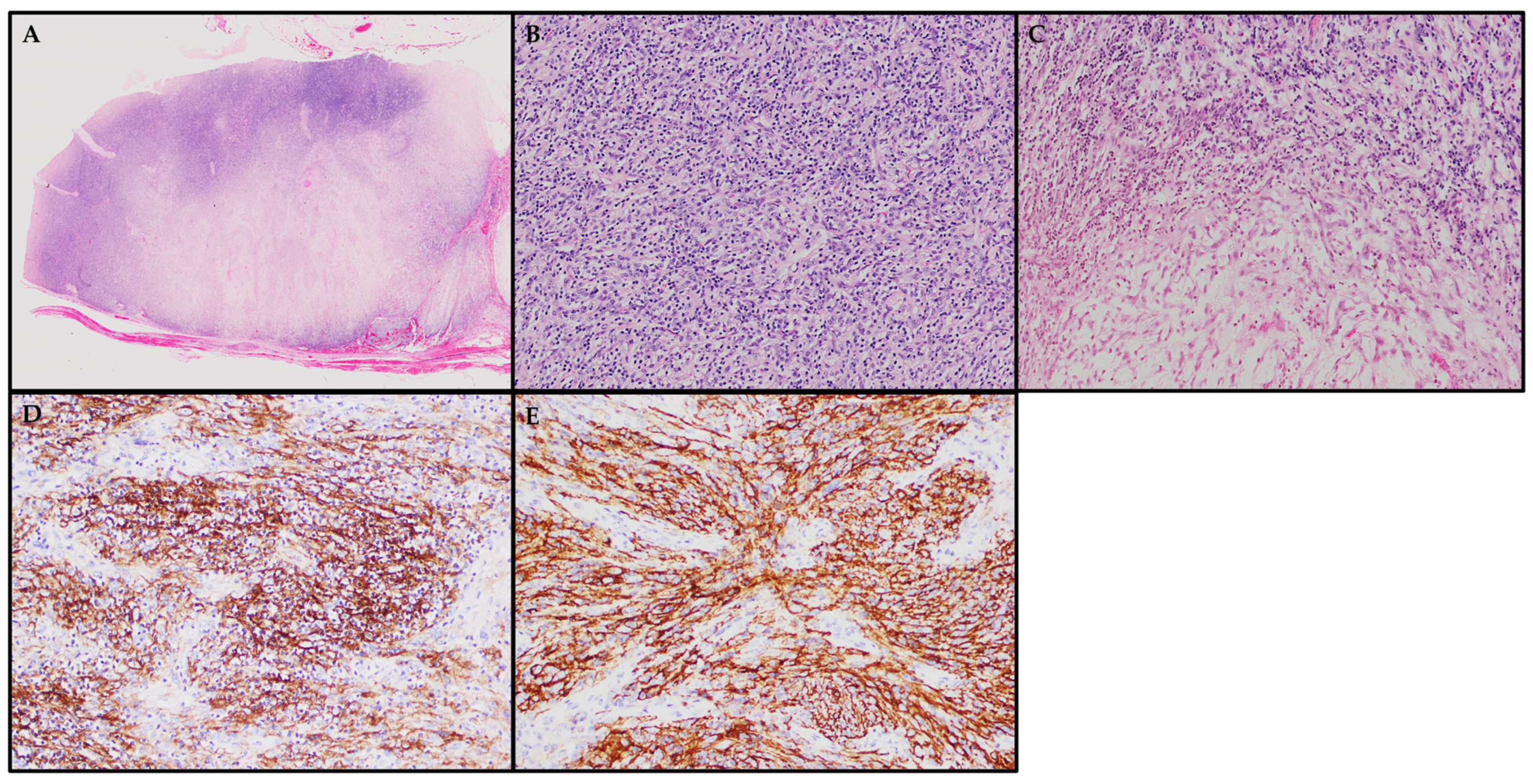 Cancers 15 05563 g004 Cancers 15 05563 g004