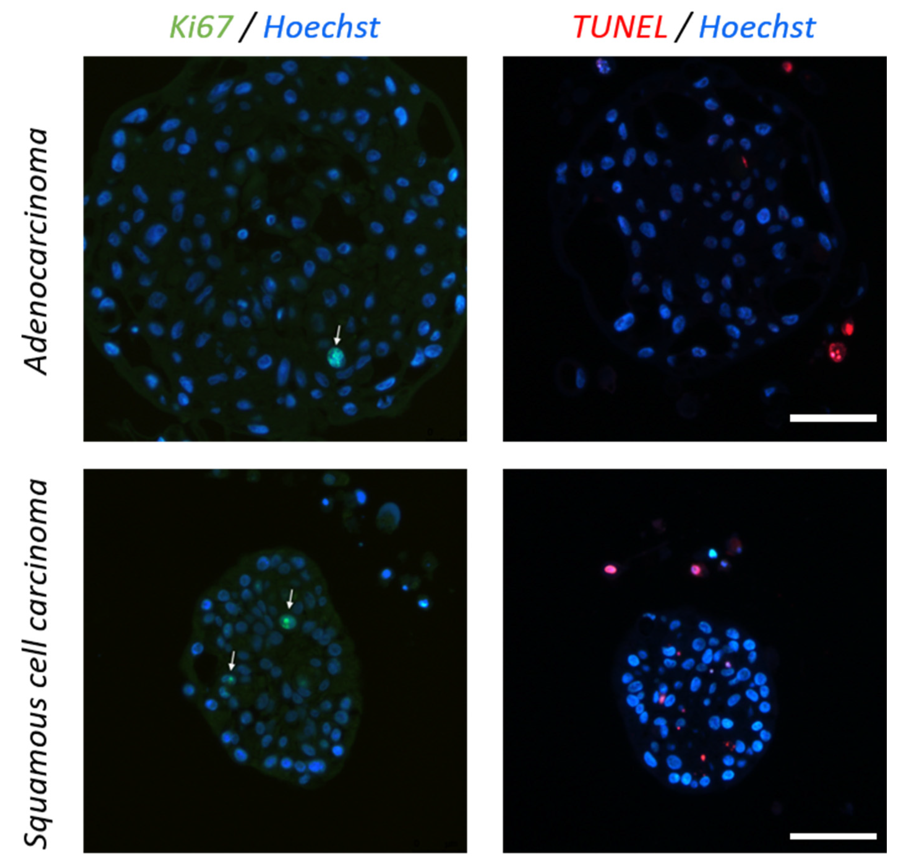 Cancers 15 05576 g006