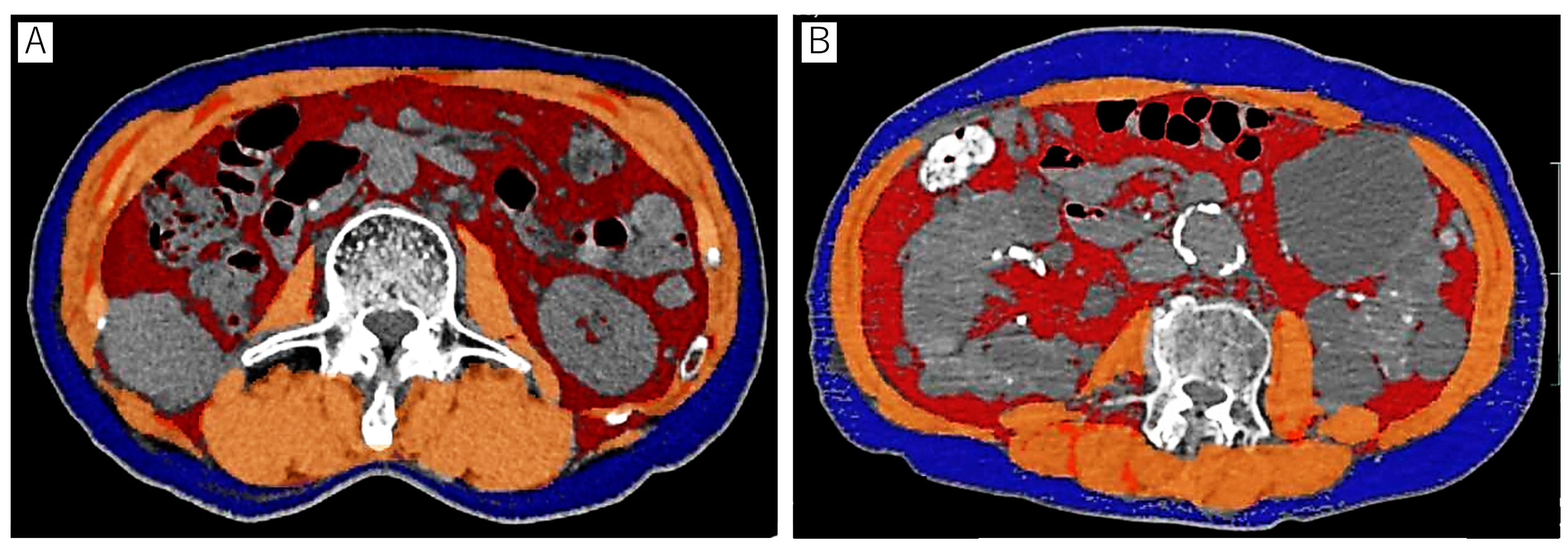 Cancers 15 05591 g001