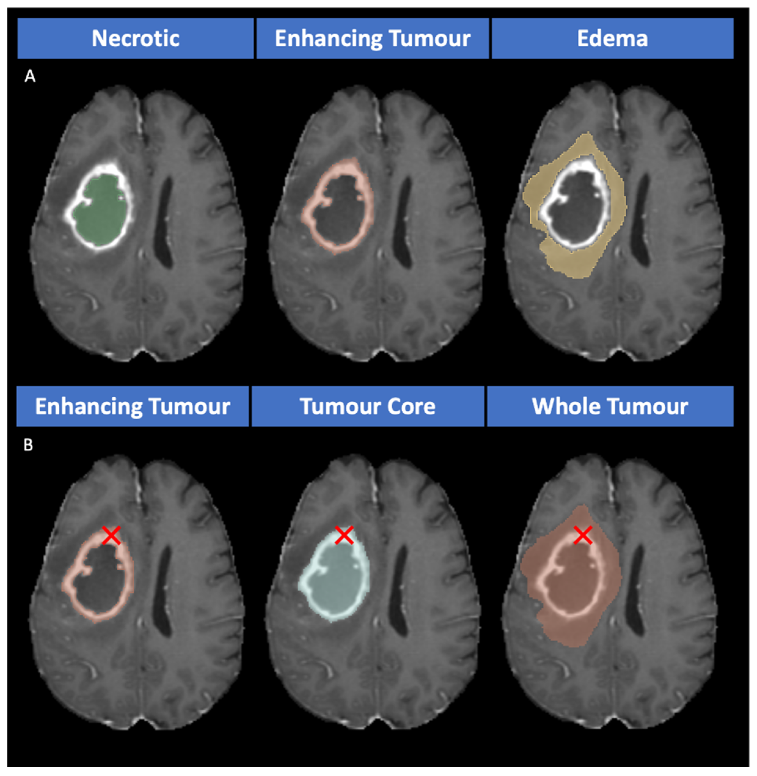 Cancers 15 05620 g003