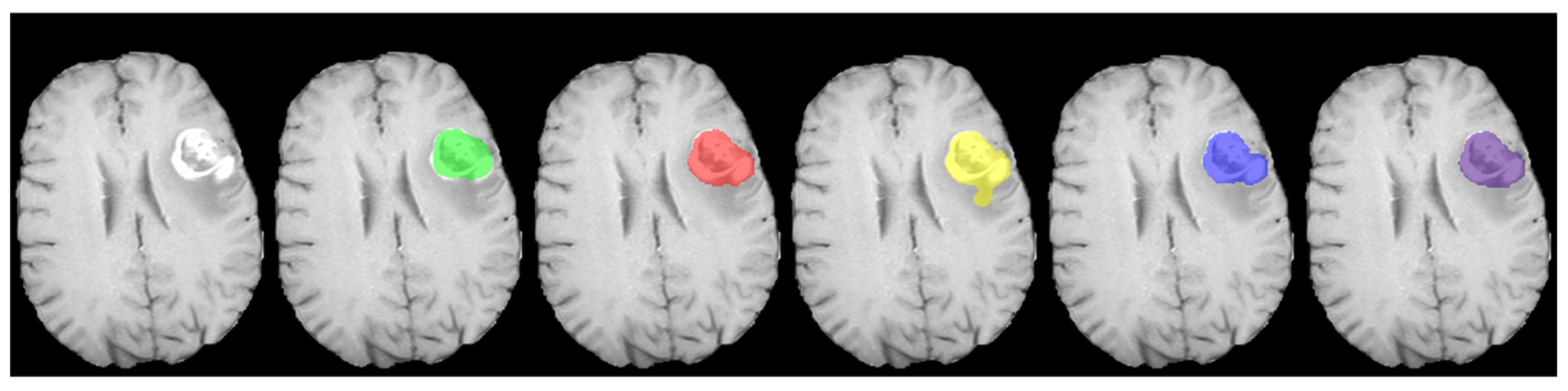 Cancers 15 05620 g007