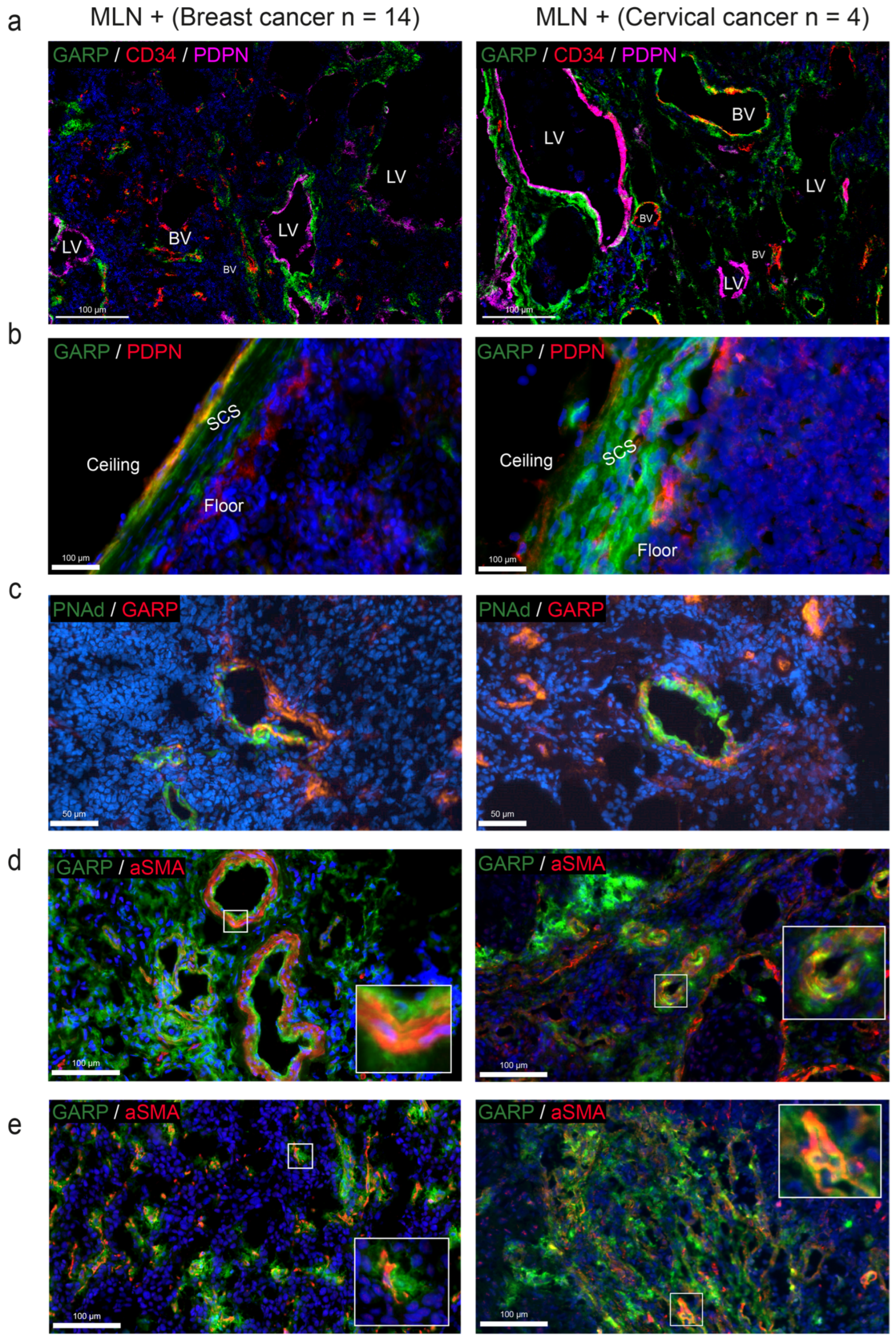 Cancers 15 05621 g004