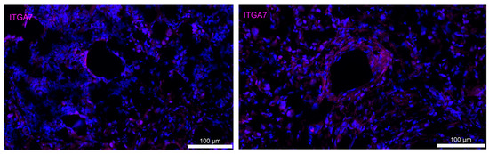 Cancers 15 05621 g0a4