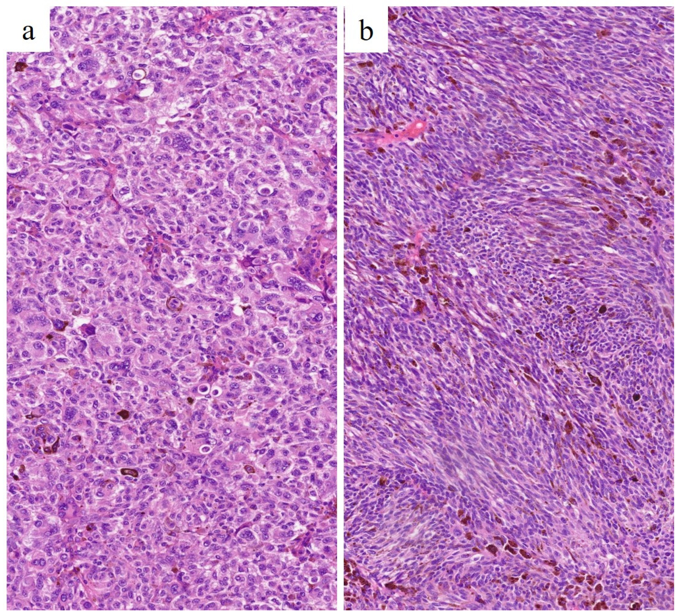 Cancers 15 05627 g005