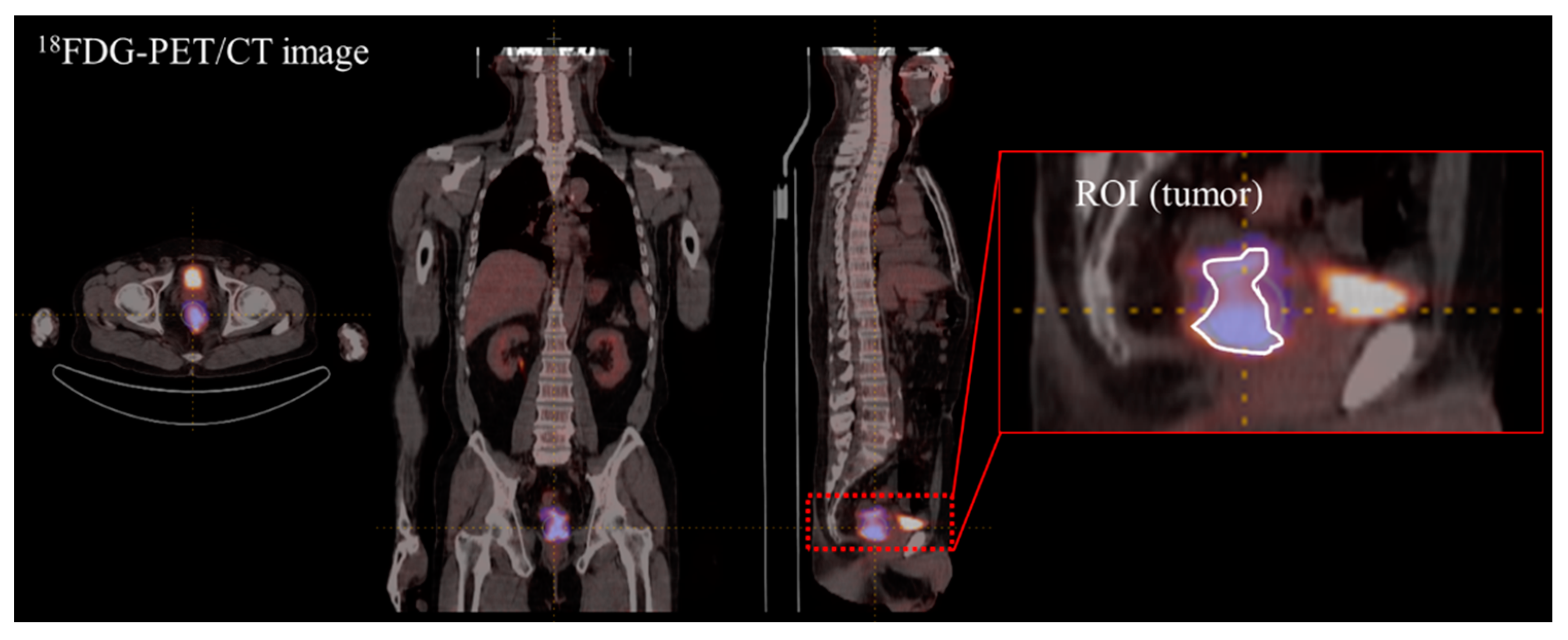 Cancers 15 05662 g002