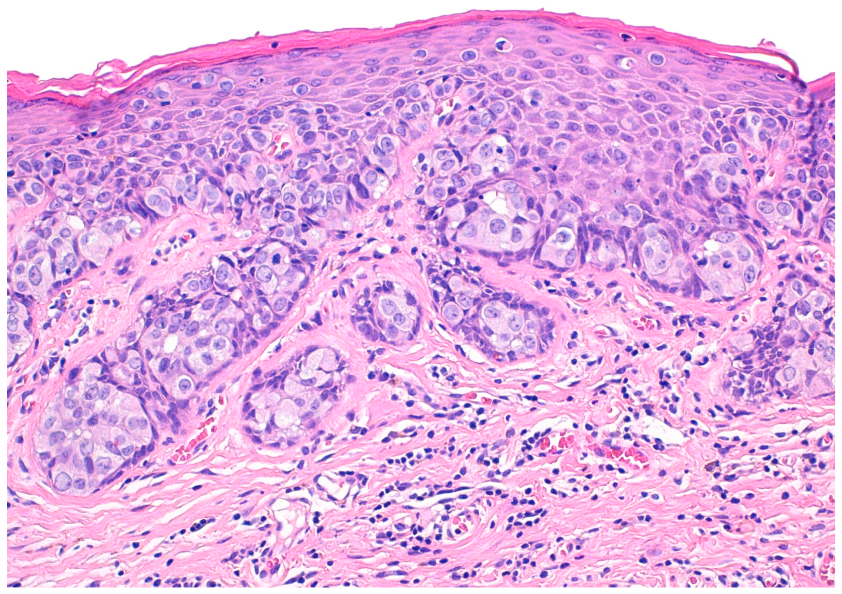 Cancers 15 05665 g001 Cancers 15 05665 g001