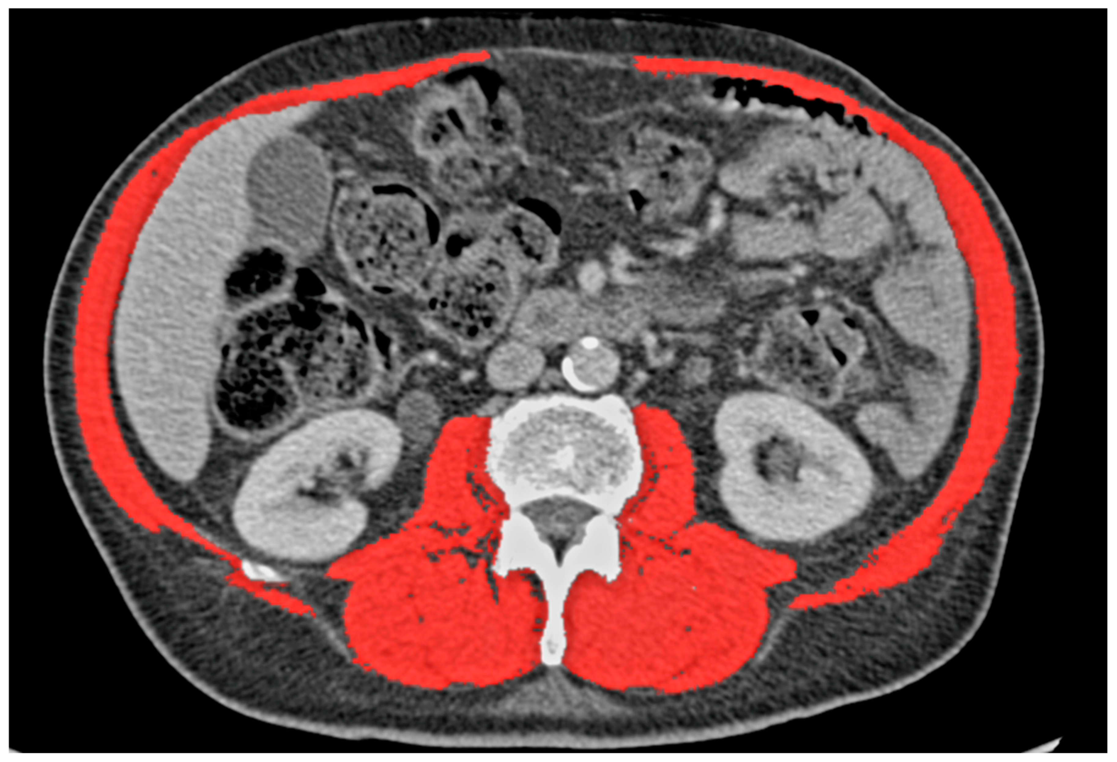 Cancers 15 05666 g001