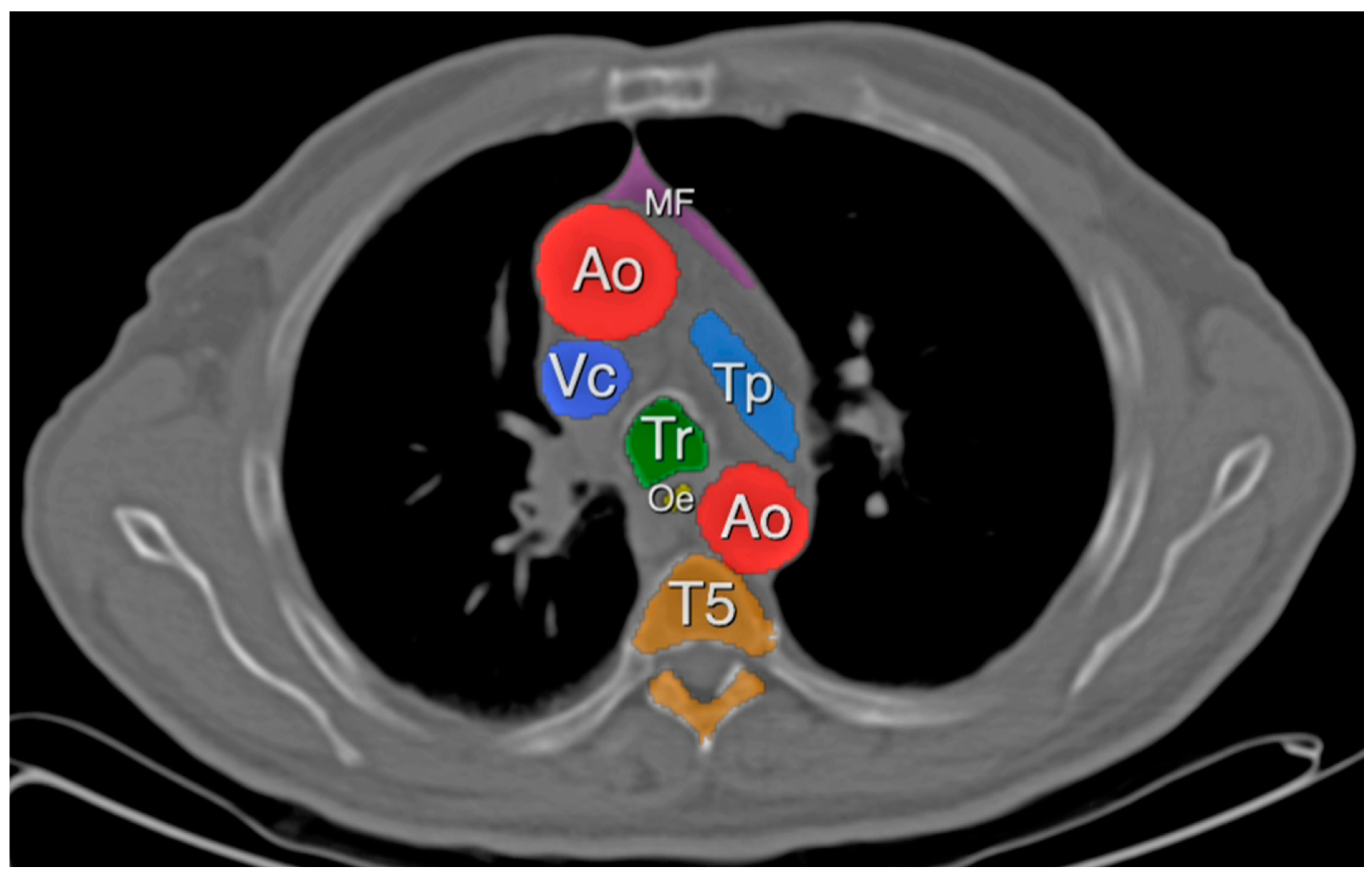 Cancers 15 05666 g002