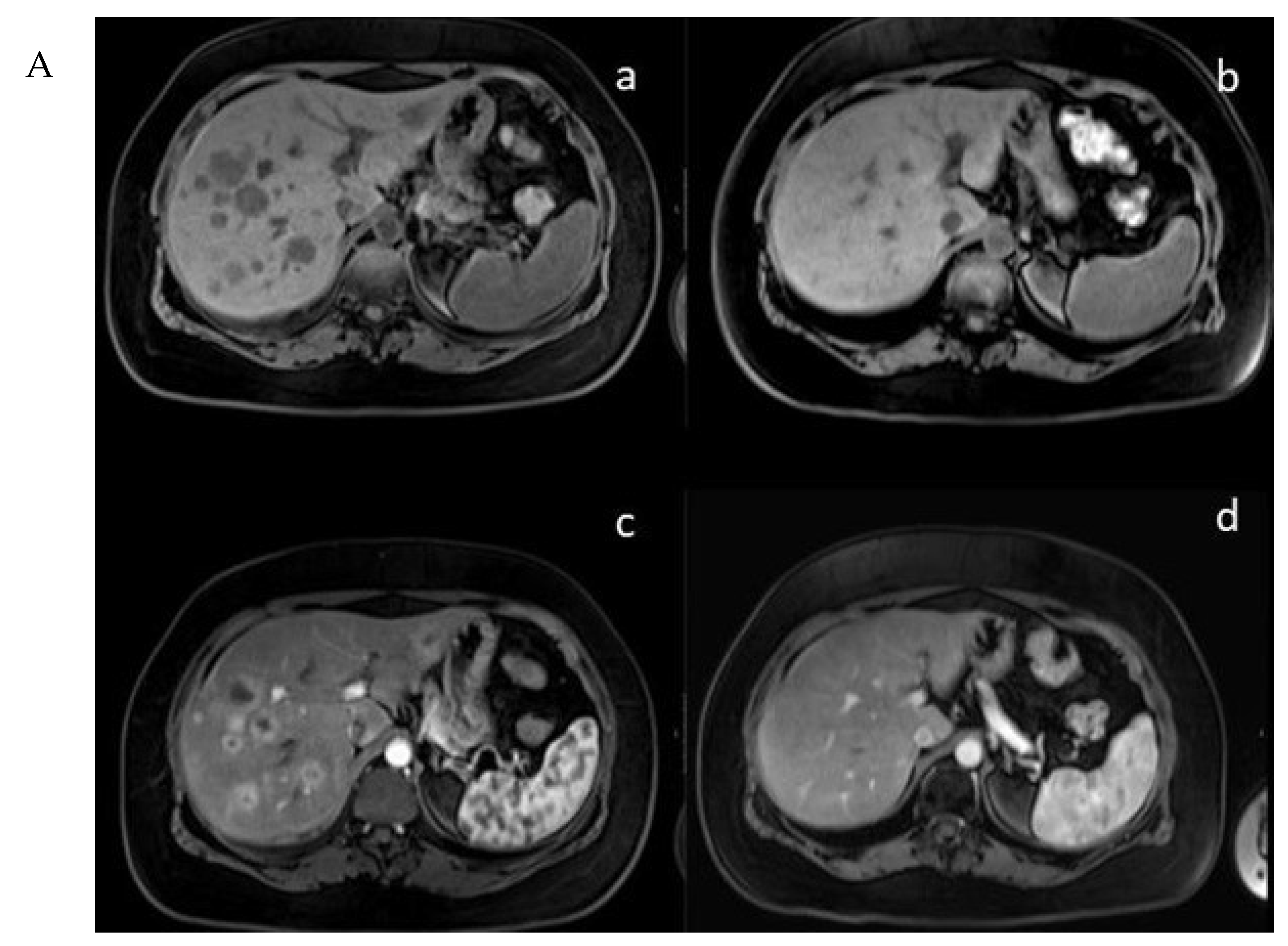 Cancers 15 05688 g003a