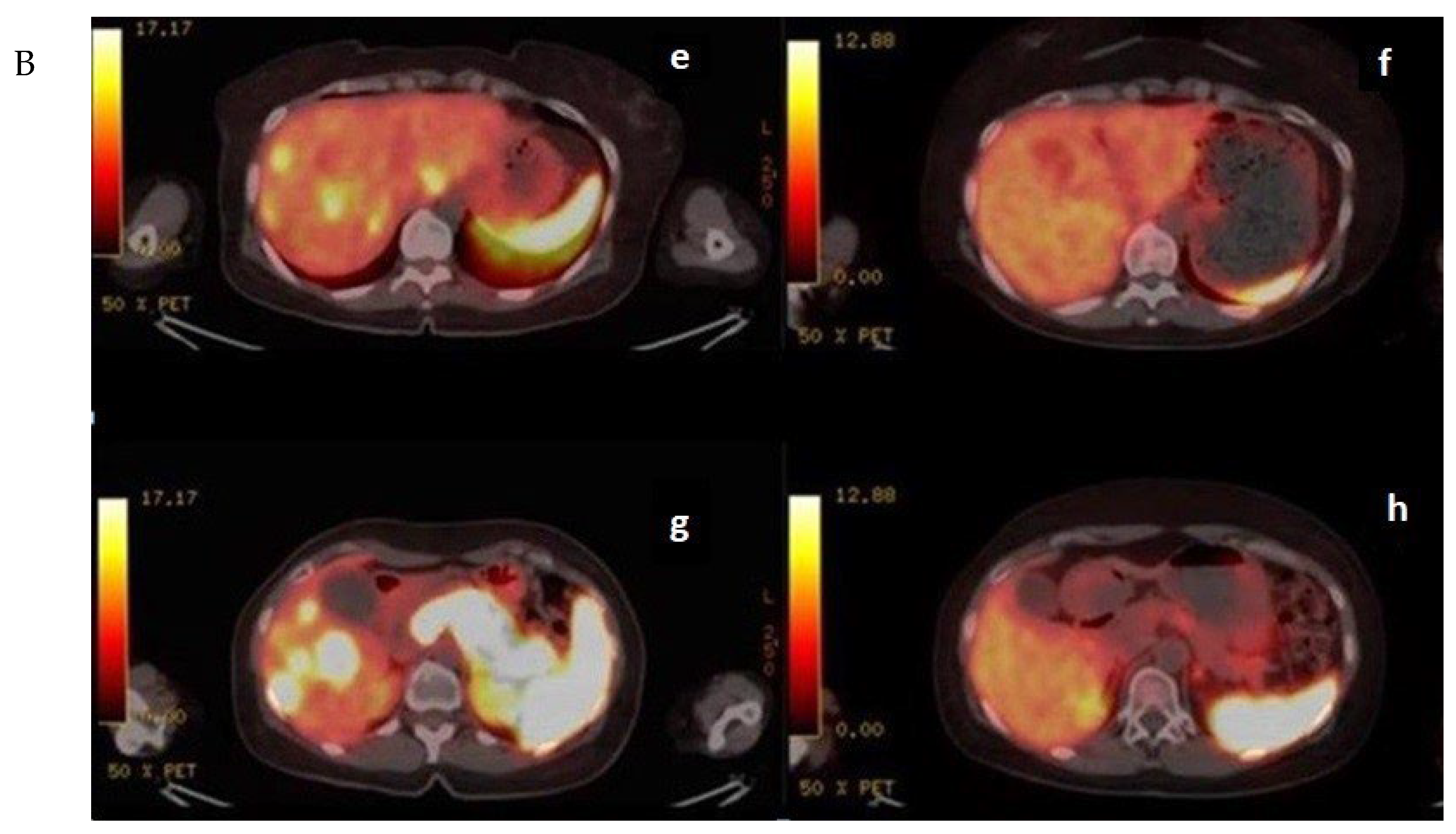 Cancers 15 05688 g003b