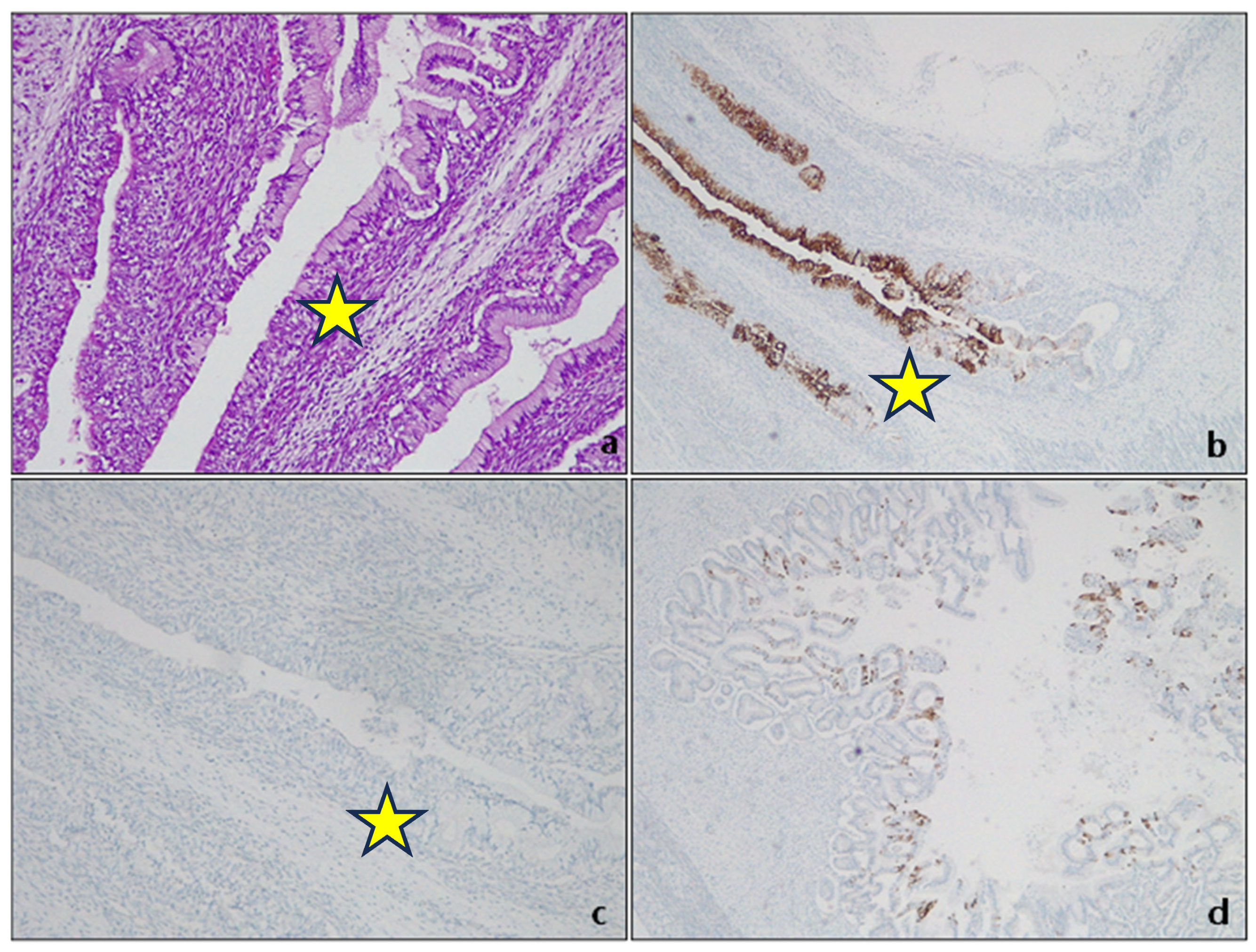 Cancers 15 05725 g001 Cancers 15 05725 g001