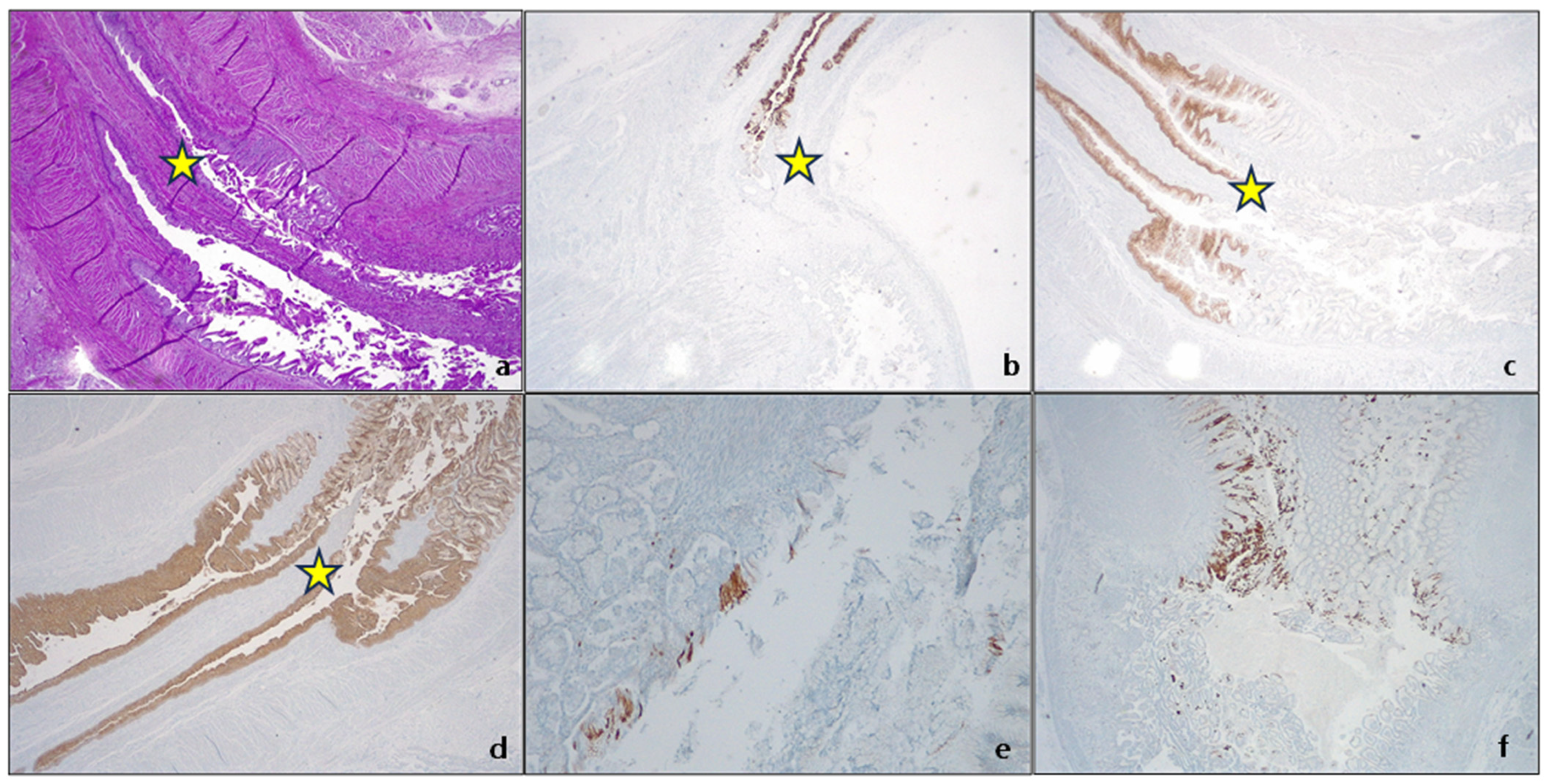 Cancers 15 05725 g002 Cancers 15 05725 g002