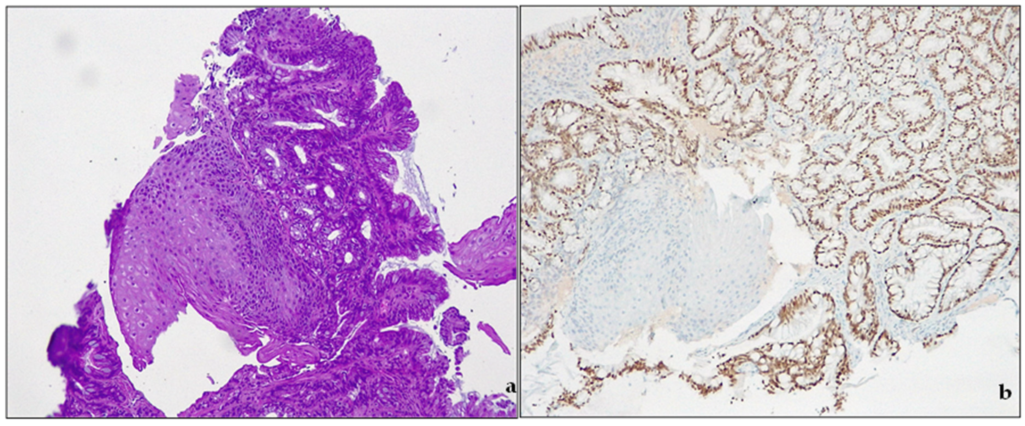 Cancers 15 05725 g003 Cancers 15 05725 g003