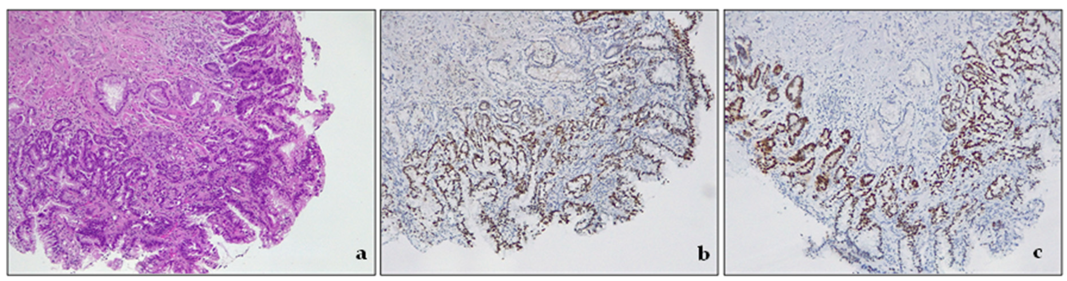 Cancers 15 05725 g004 Cancers 15 05725 g004