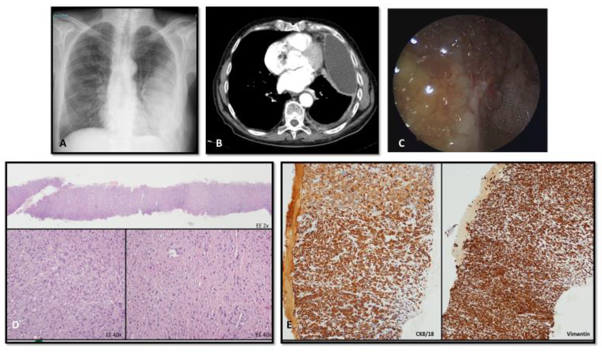 Cancers 15 05731 g002