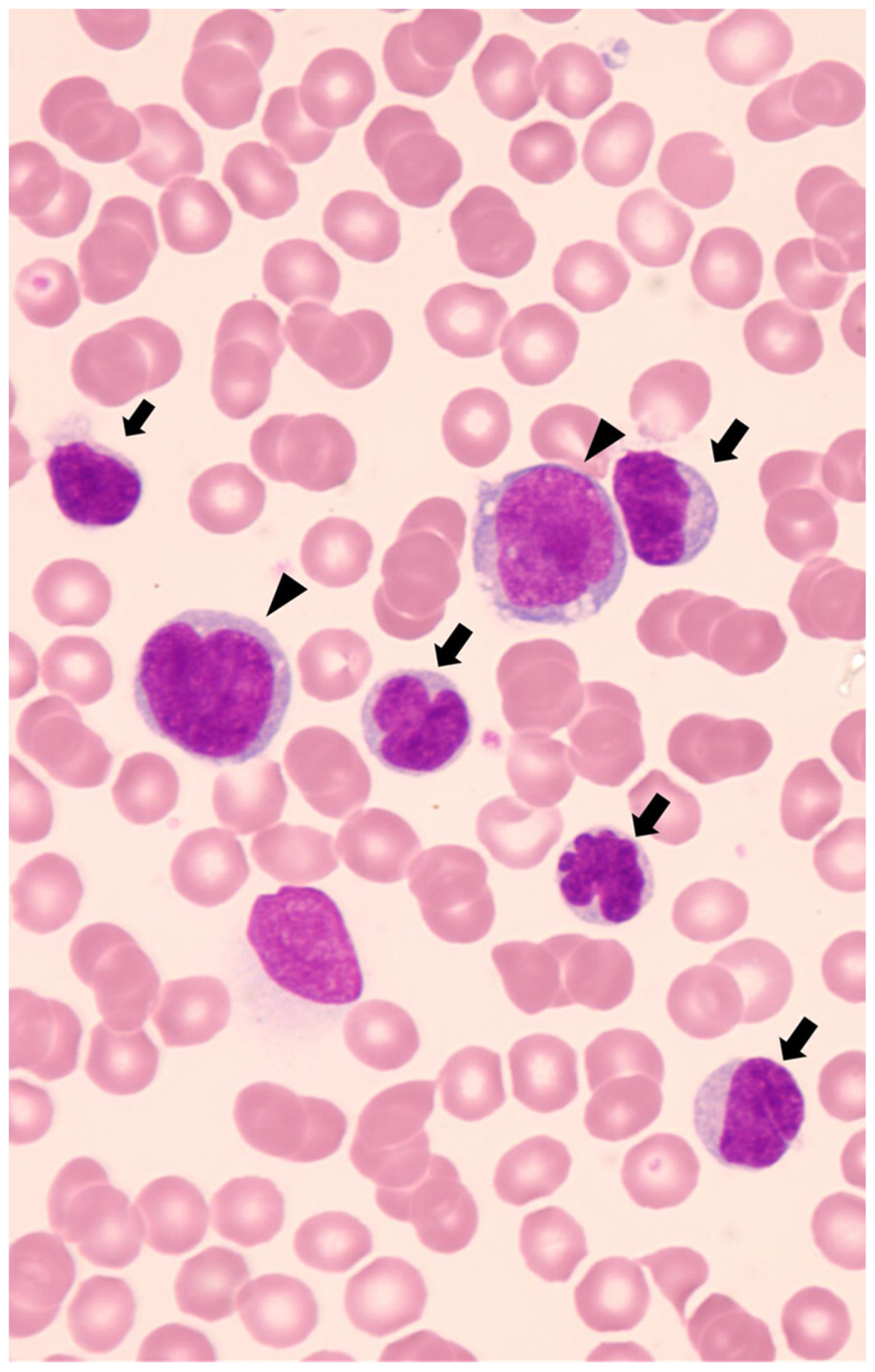 Cancers 15 05733 g001