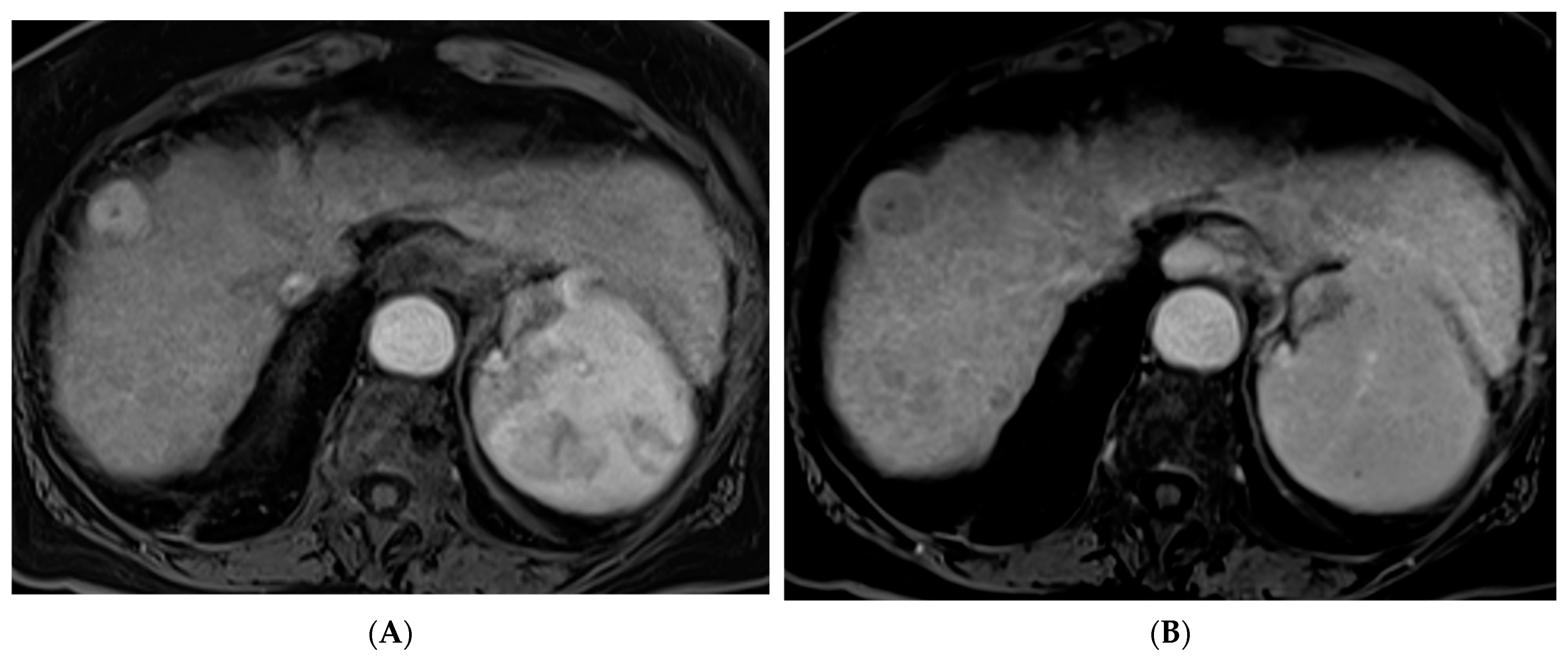 Cancers 15 05749 g002a