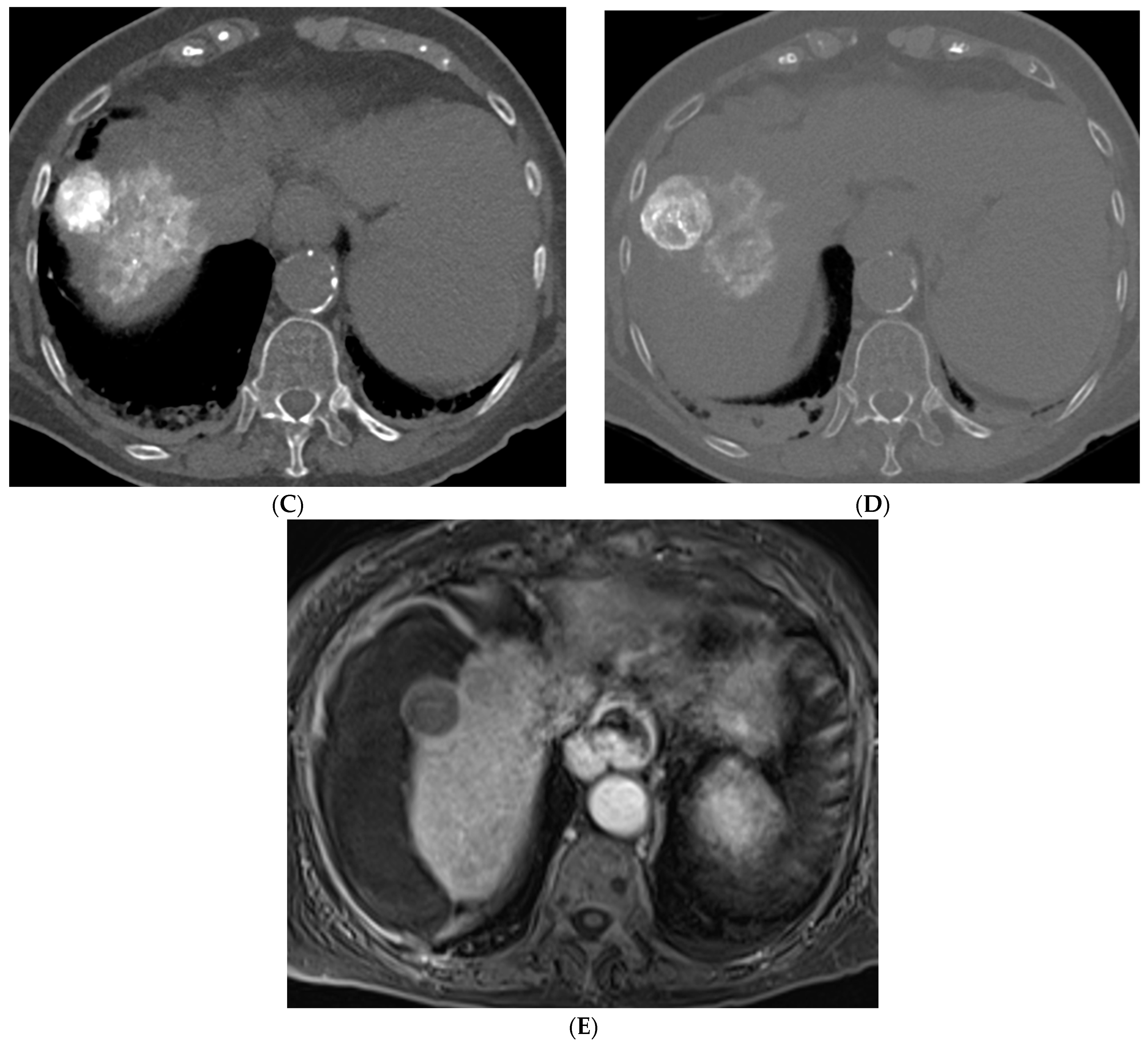 Cancers 15 05749 g002b