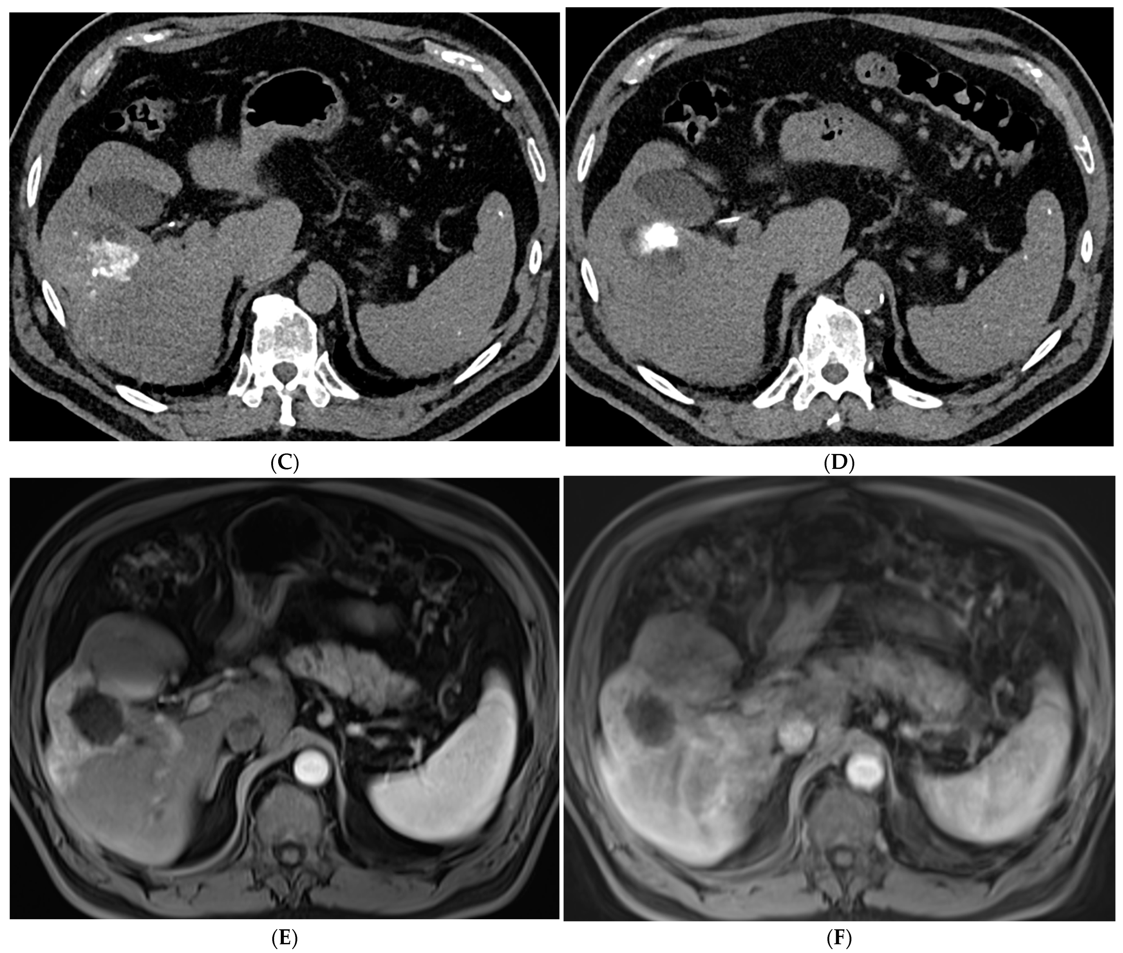 Cancers 15 05749 g003b