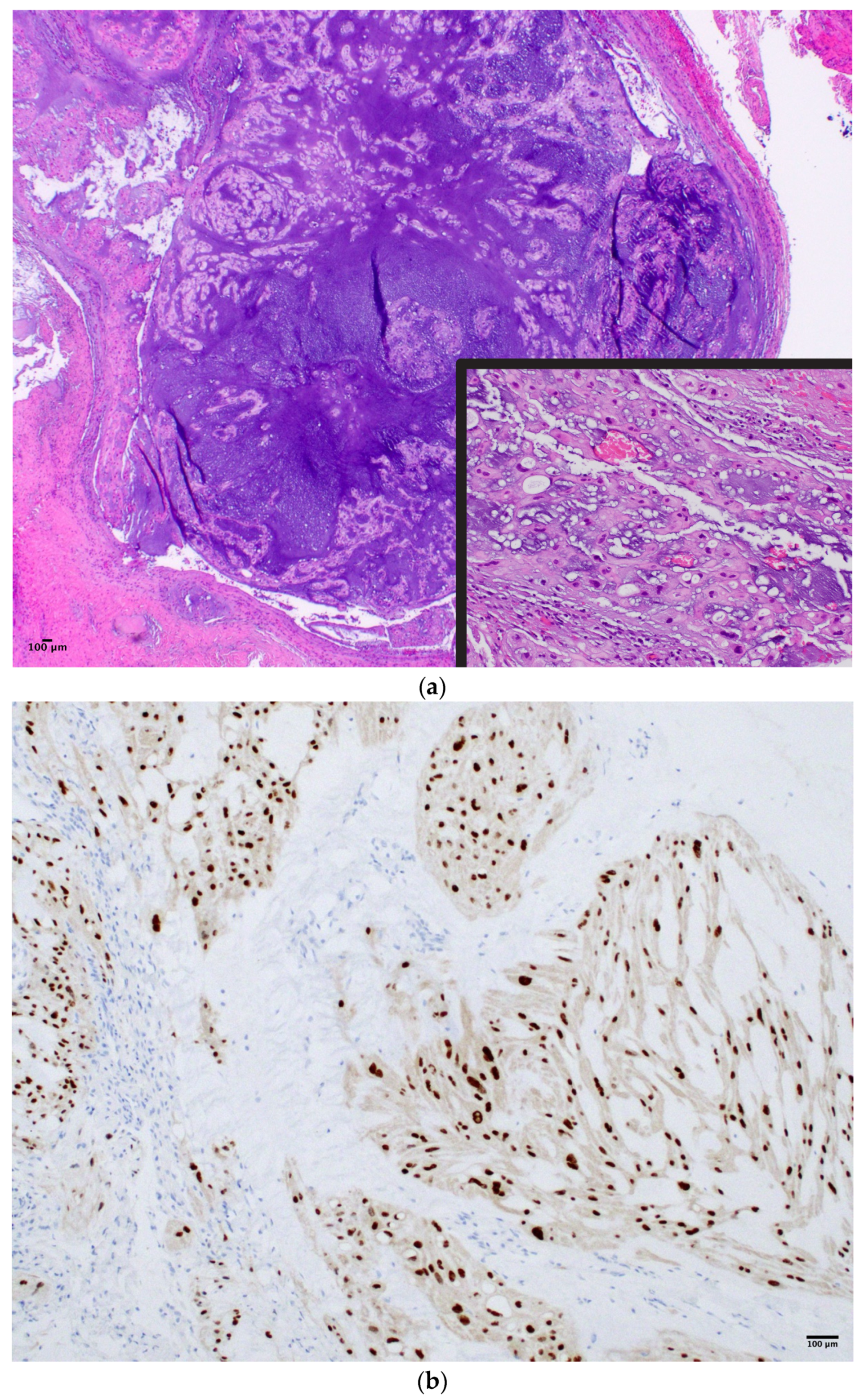 Cancers 15 05800 g001