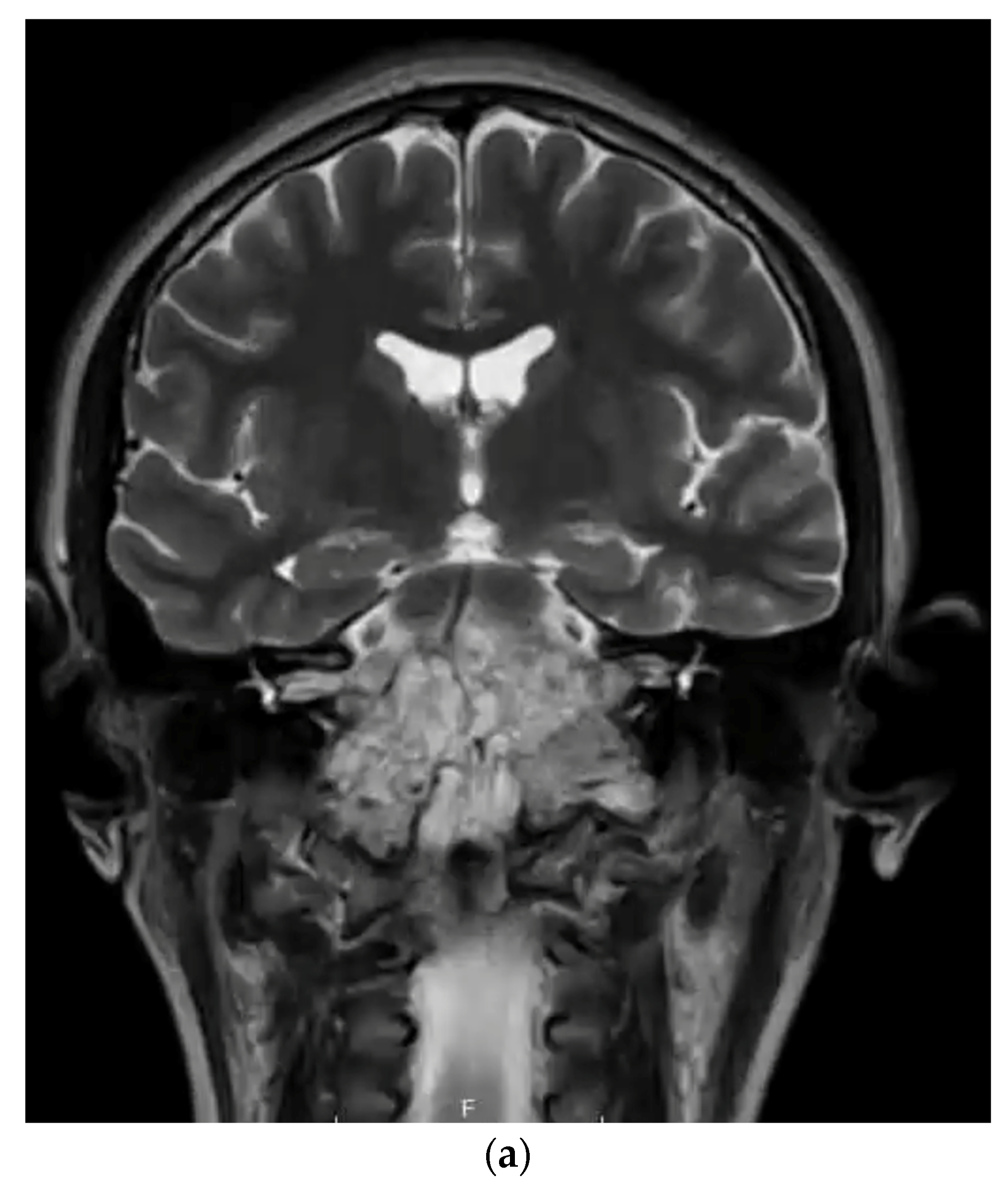 Cancers 15 05800 g002a