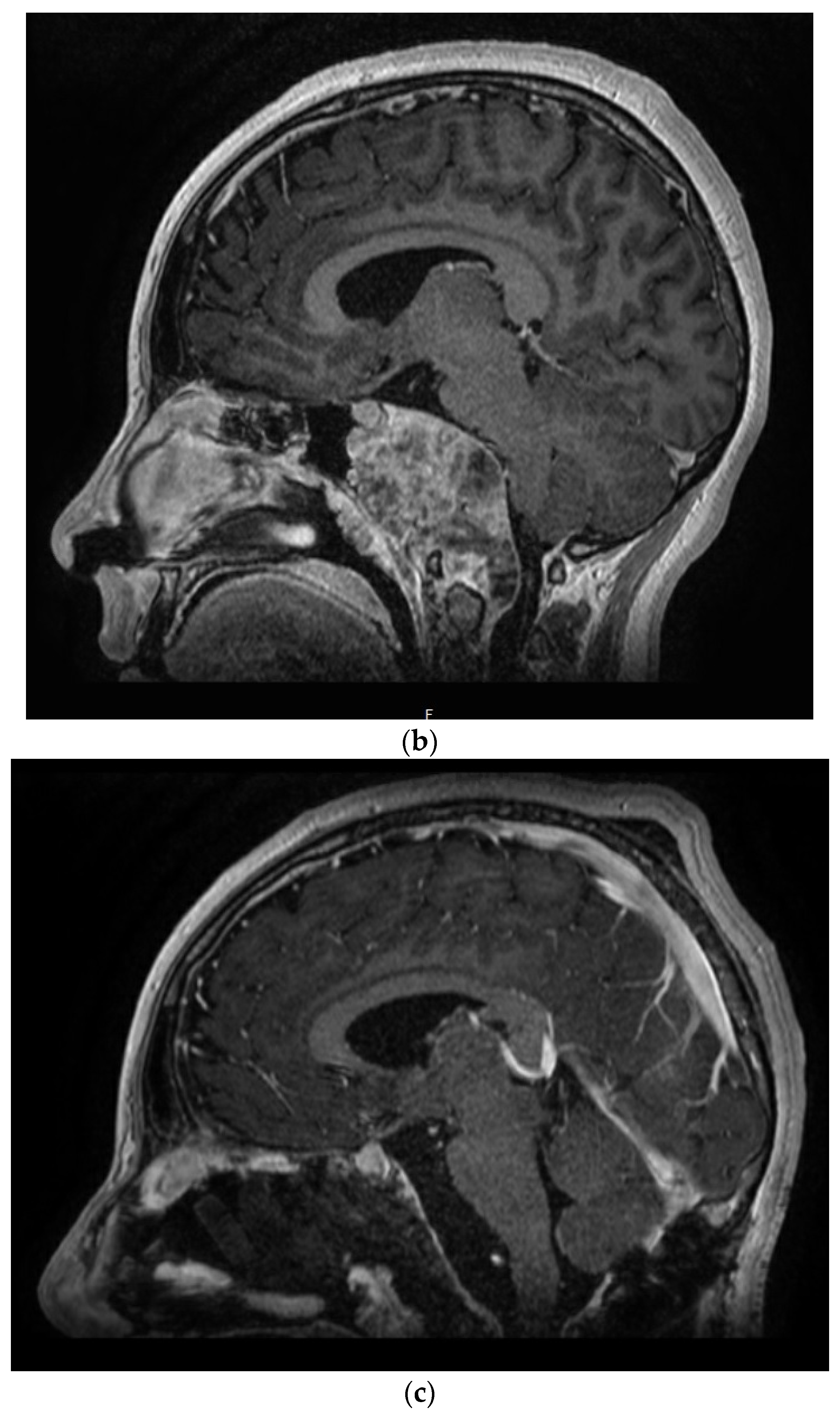 Cancers 15 05800 g002b
