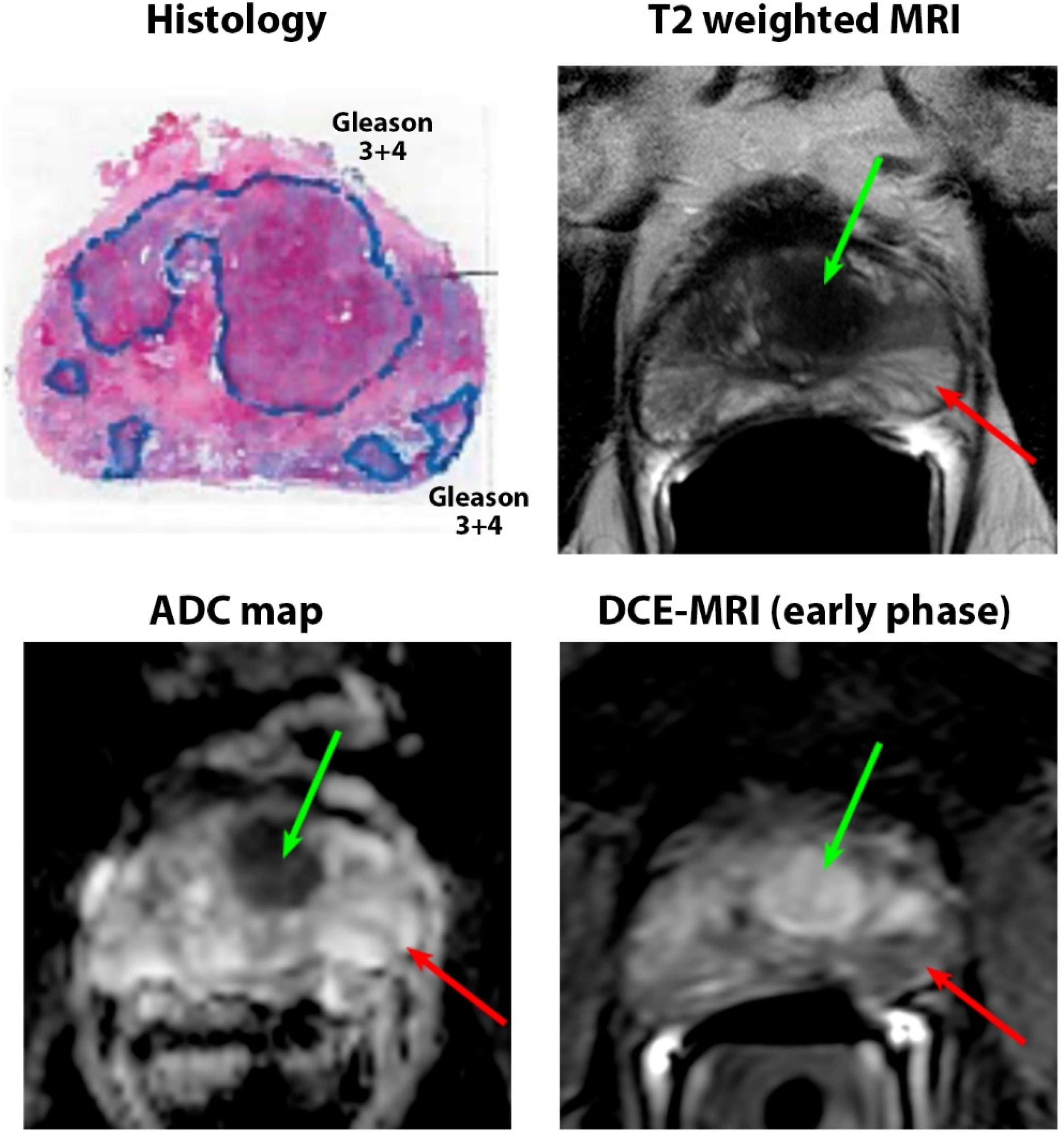 Cancers 15 05825 g001