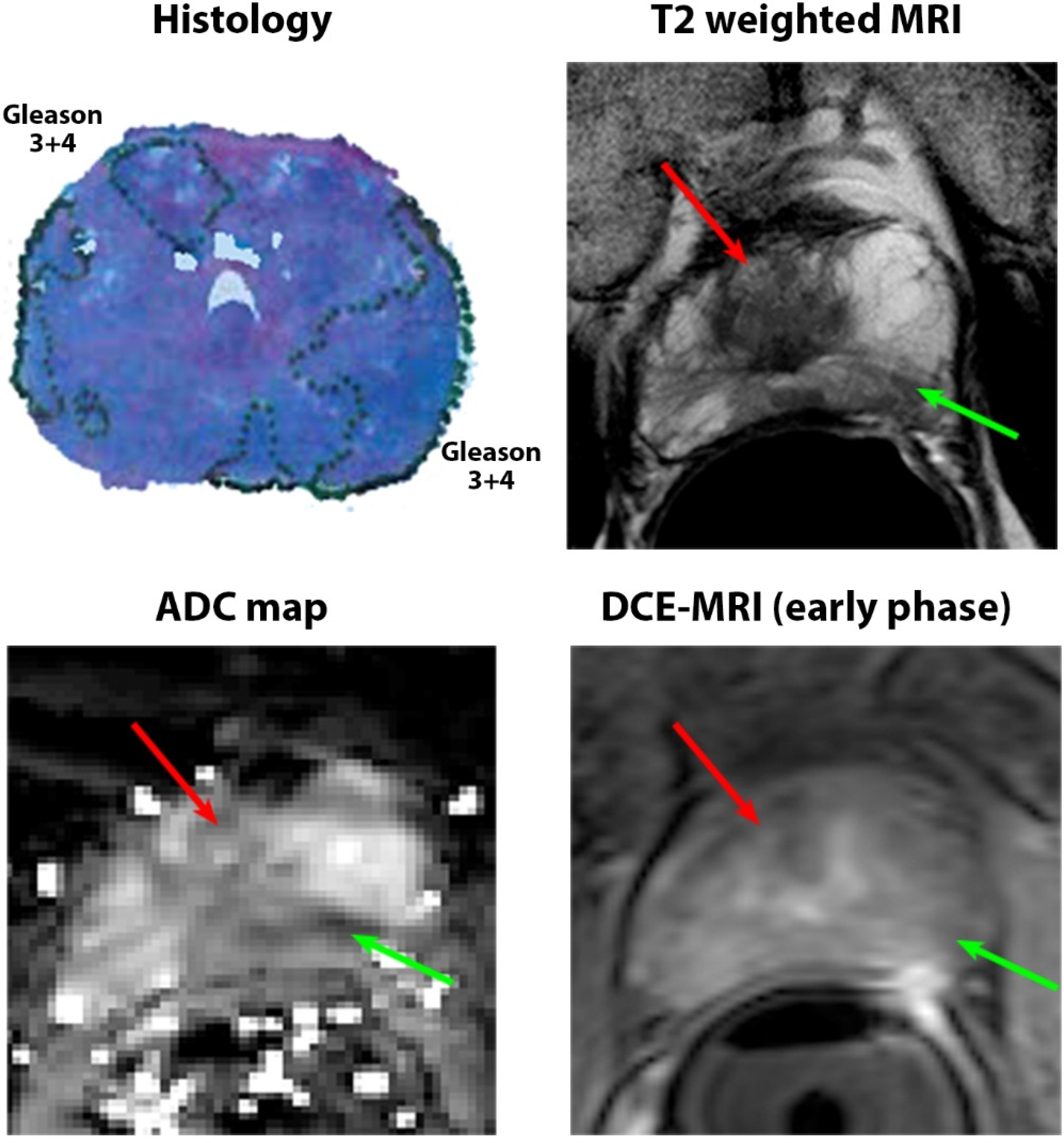 Cancers 15 05825 g002