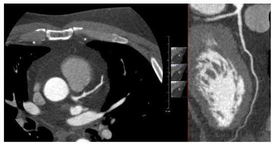 Cancers 15 05831 g0a1