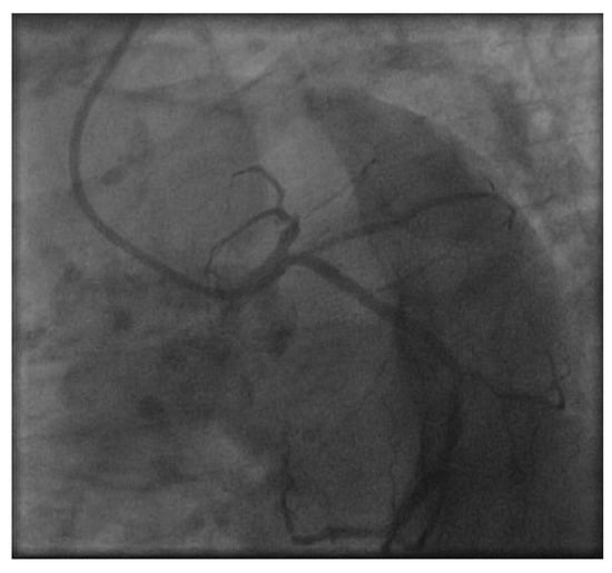 Cancers 15 05831 g0a2