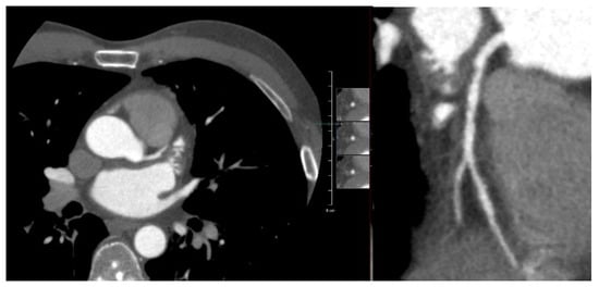 Cancers 15 05831 g0a3