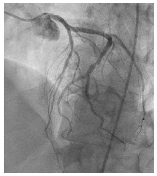 Cancers 15 05831 g0a4