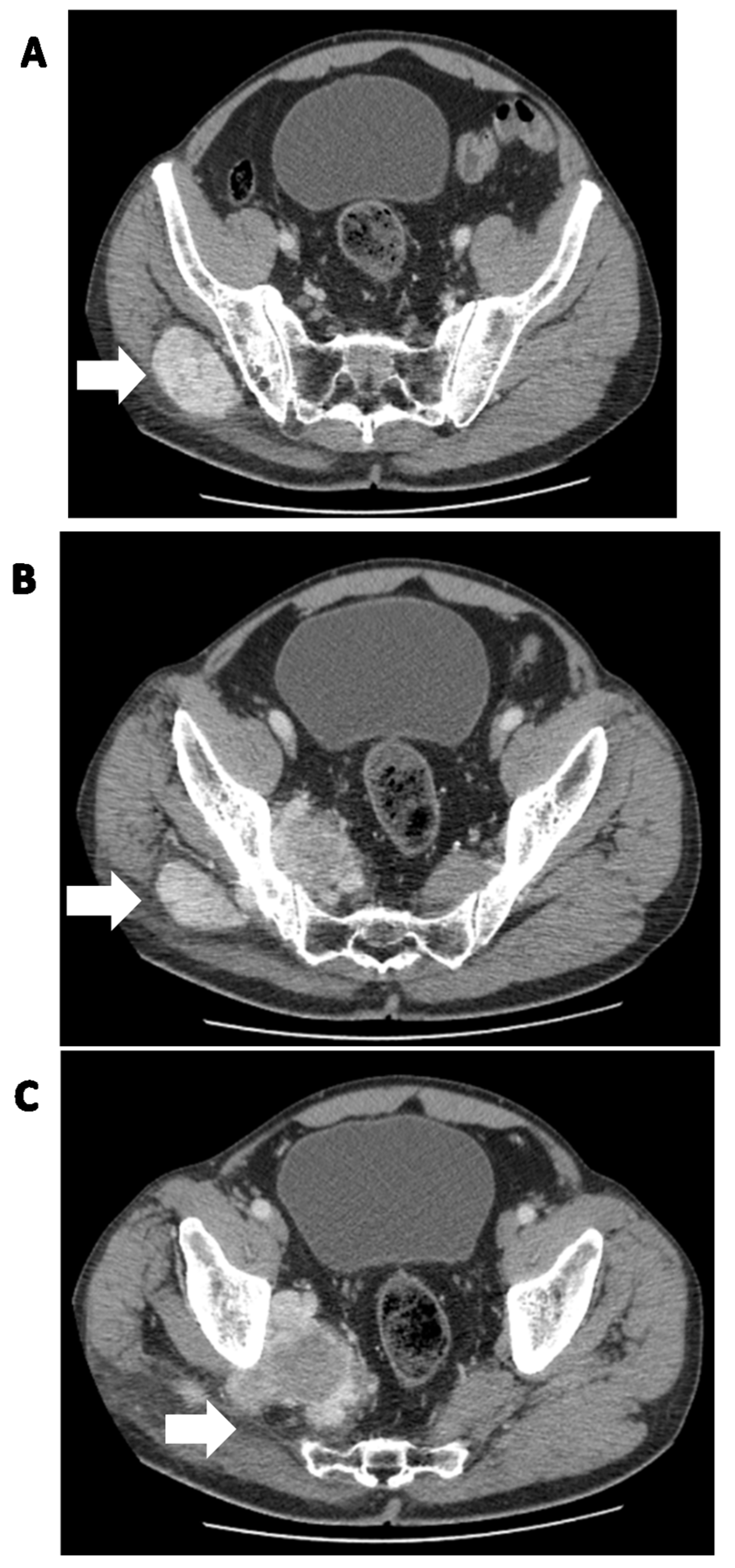 Cancers 15 05854 g001 Cancers 15 05854 g001