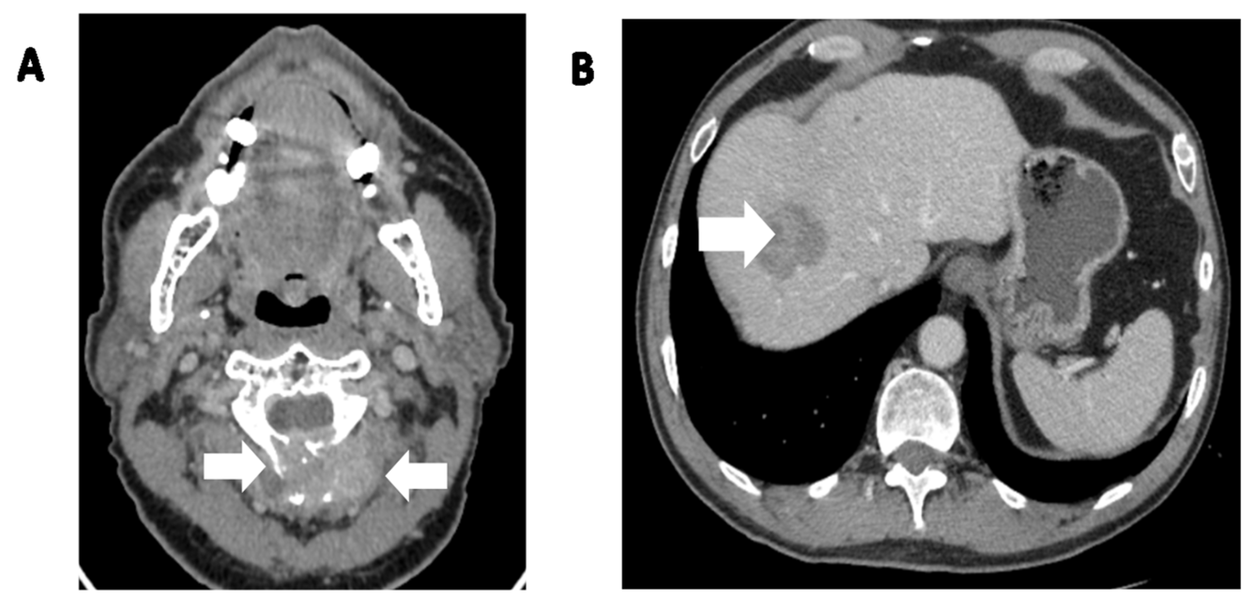 Cancers 15 05854 g002 Cancers 15 05854 g002