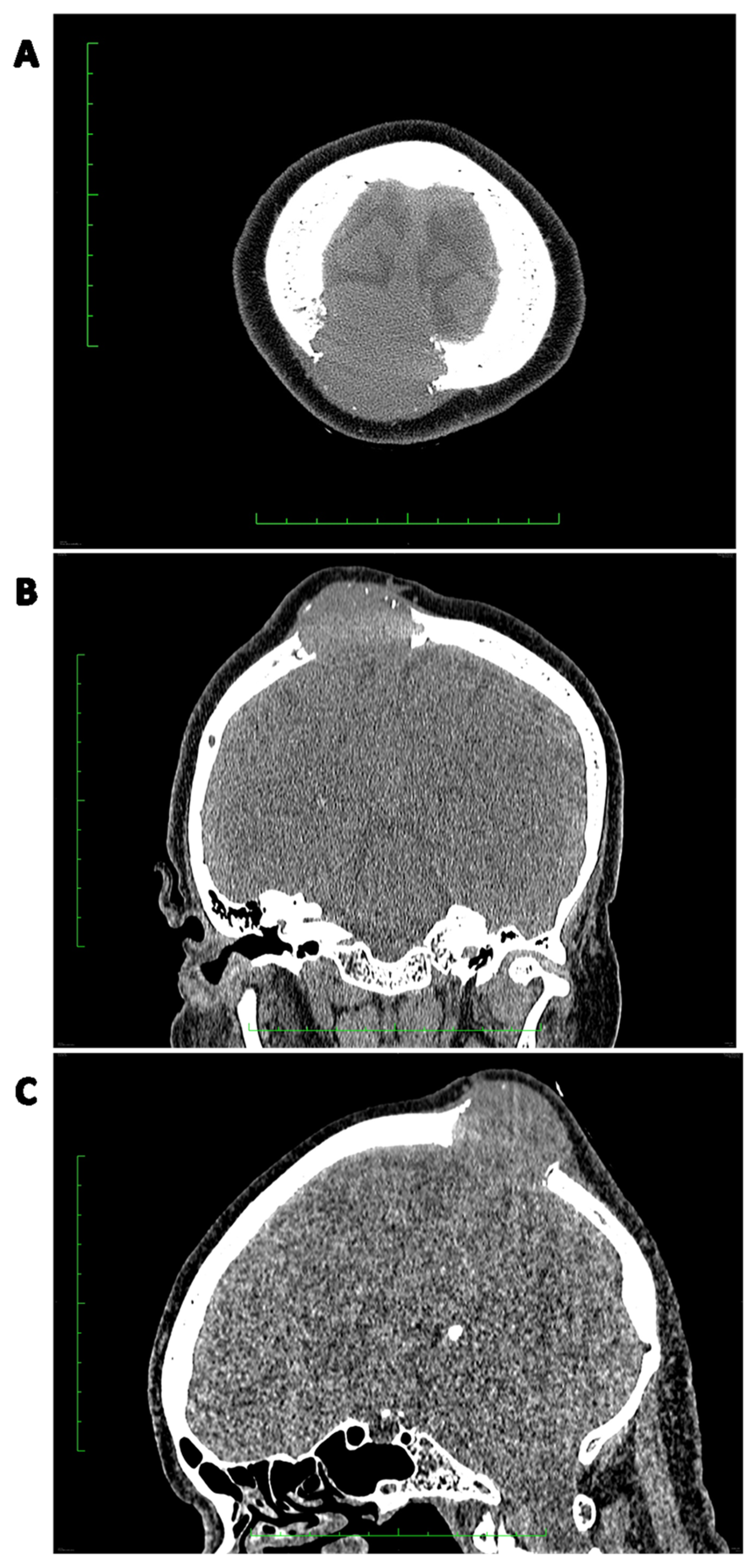 Cancers 15 05854 g003 Cancers 15 05854 g003