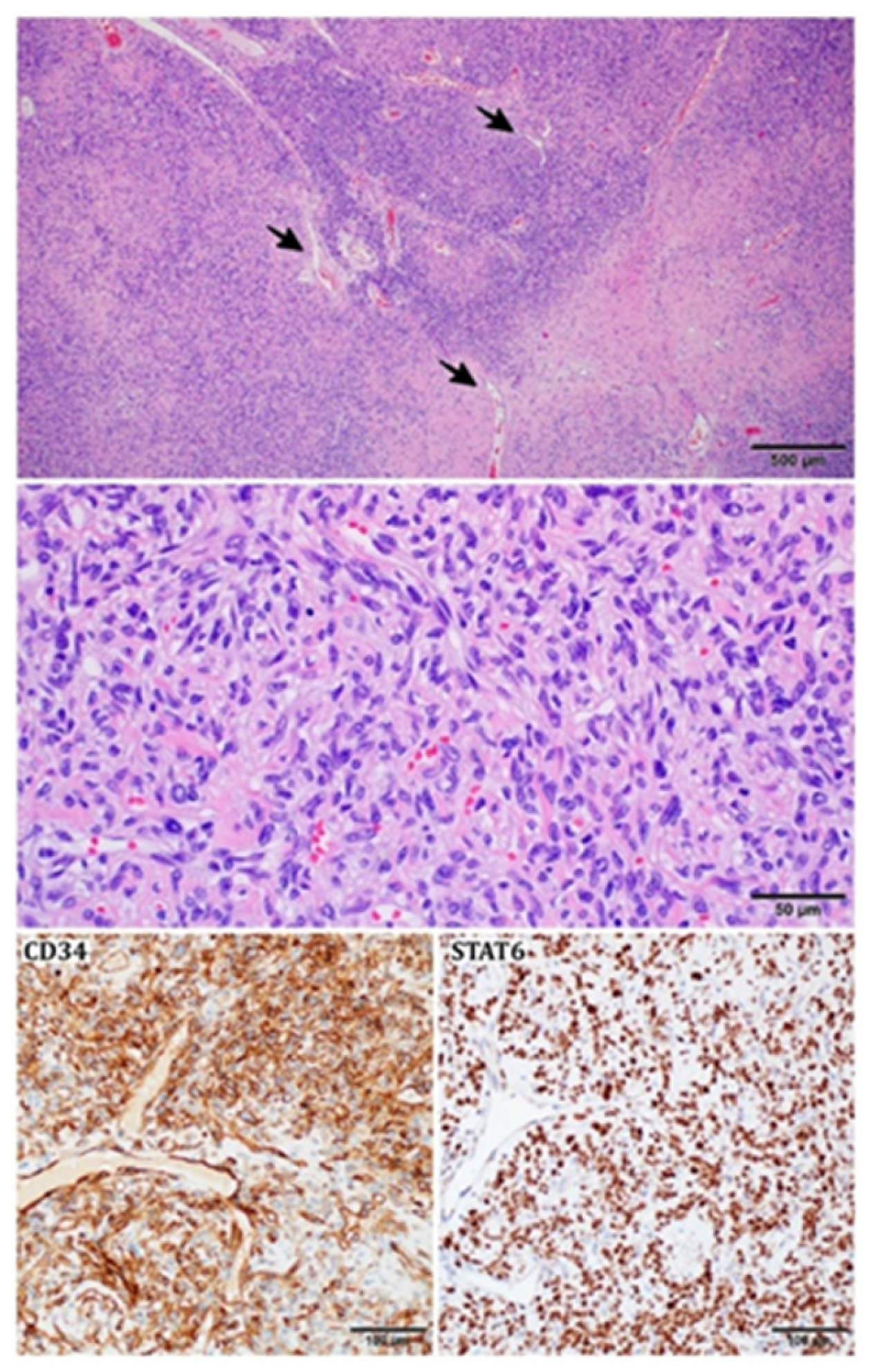 Cancers 15 05854 g004 Cancers 15 05854 g004