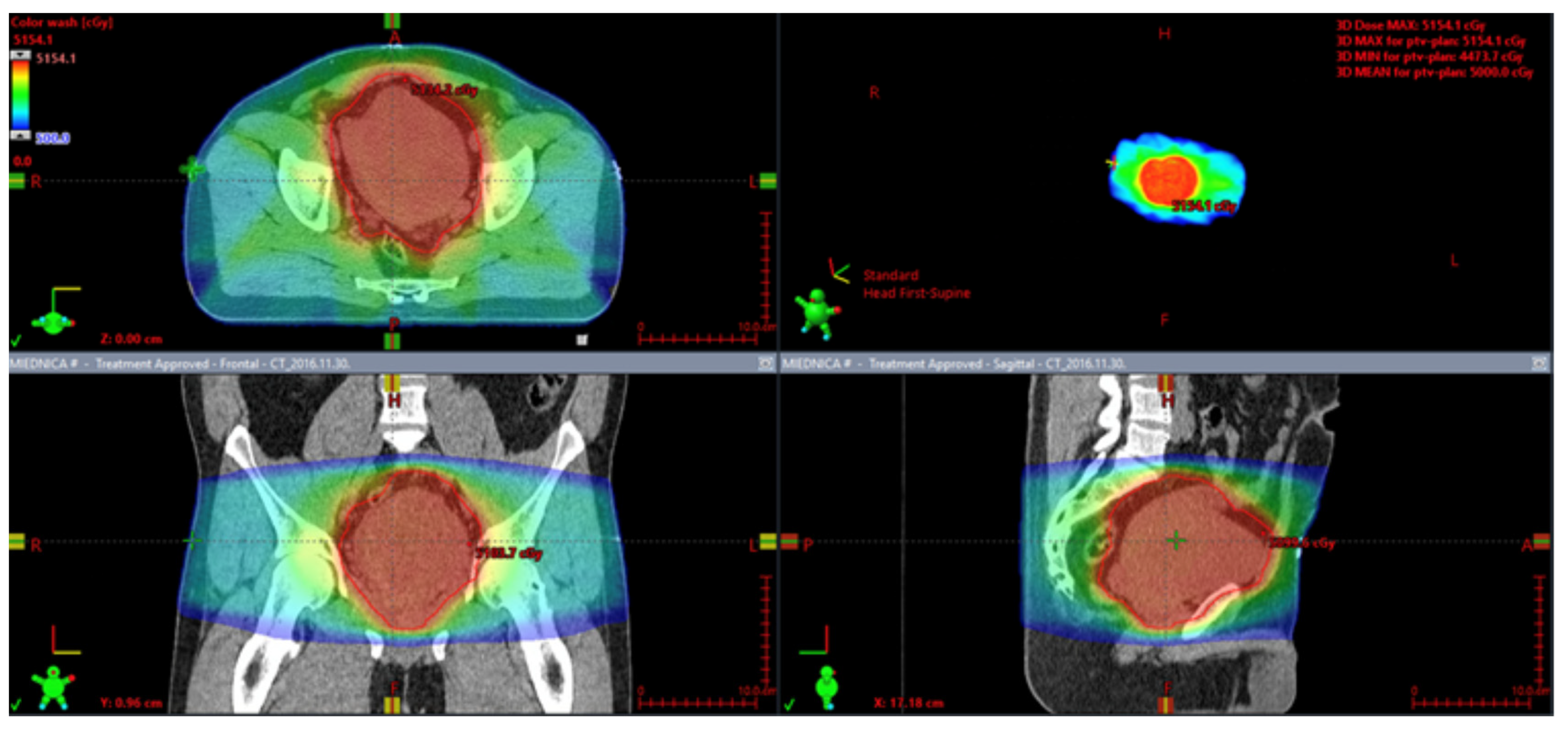 Cancers 15 05854 g007 Cancers 15 05854 g007