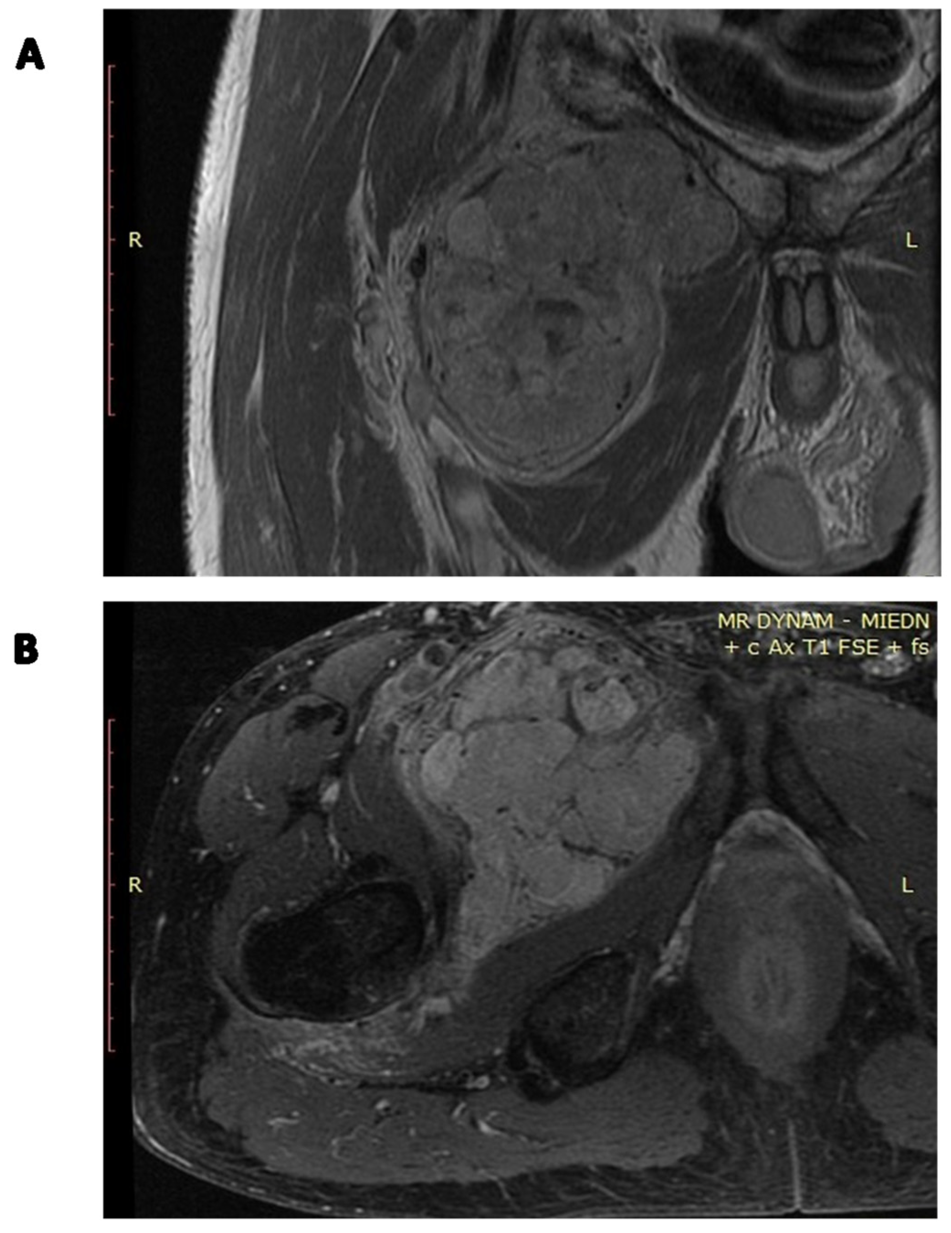 Cancers 15 05854 g008 Cancers 15 05854 g008