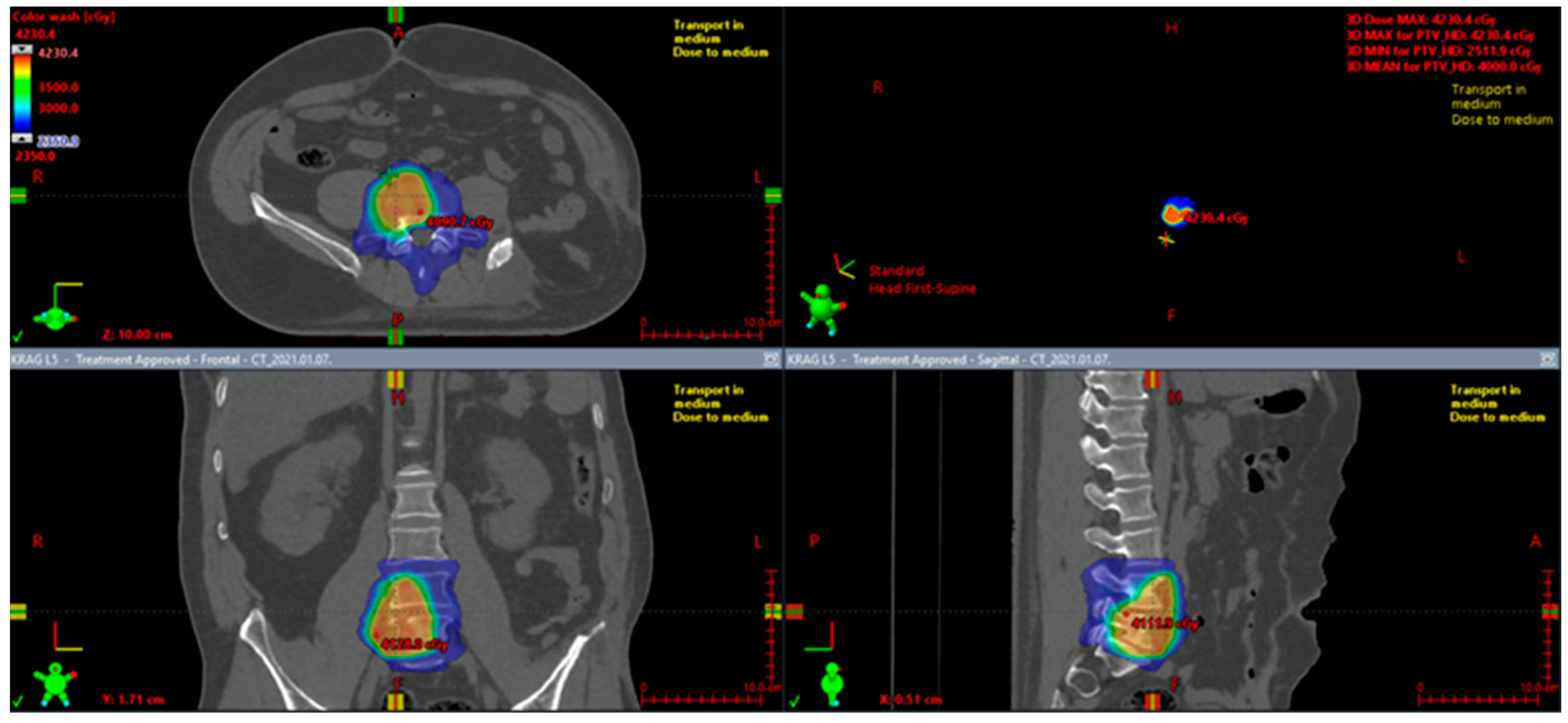 Cancers 15 05854 g009 Cancers 15 05854 g009